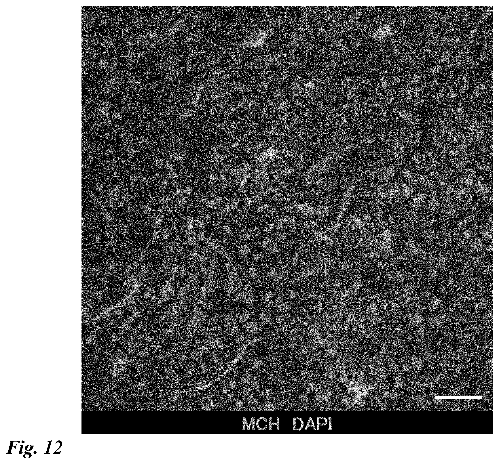 Patent US12378518 Figure 12 – Differentiation induction from human pluripotent stem cells into hypothalamic neurons