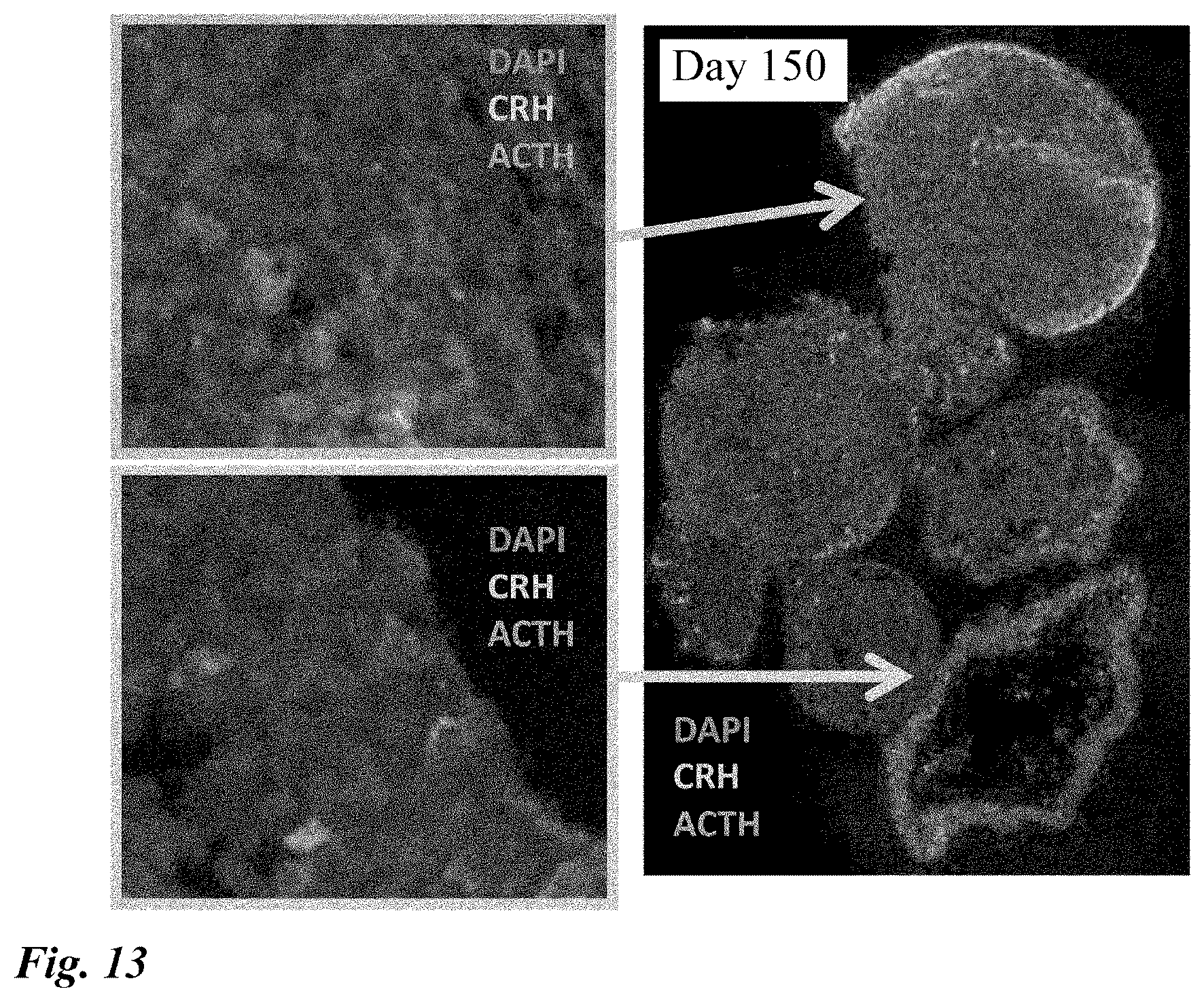 Patent US12378518 Figure 13 – Differentiation induction from human pluripotent stem cells into hypothalamic neurons