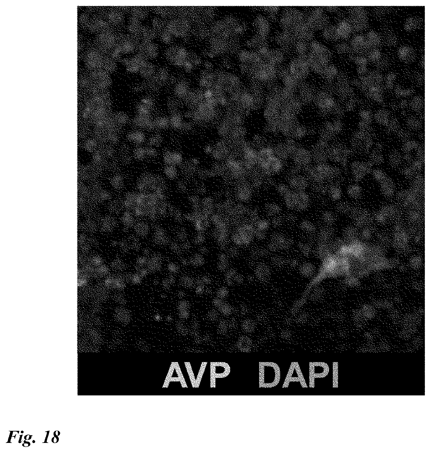 Patent US12378518 Figure 18 – Differentiation induction from human pluripotent stem cells into hypothalamic neurons