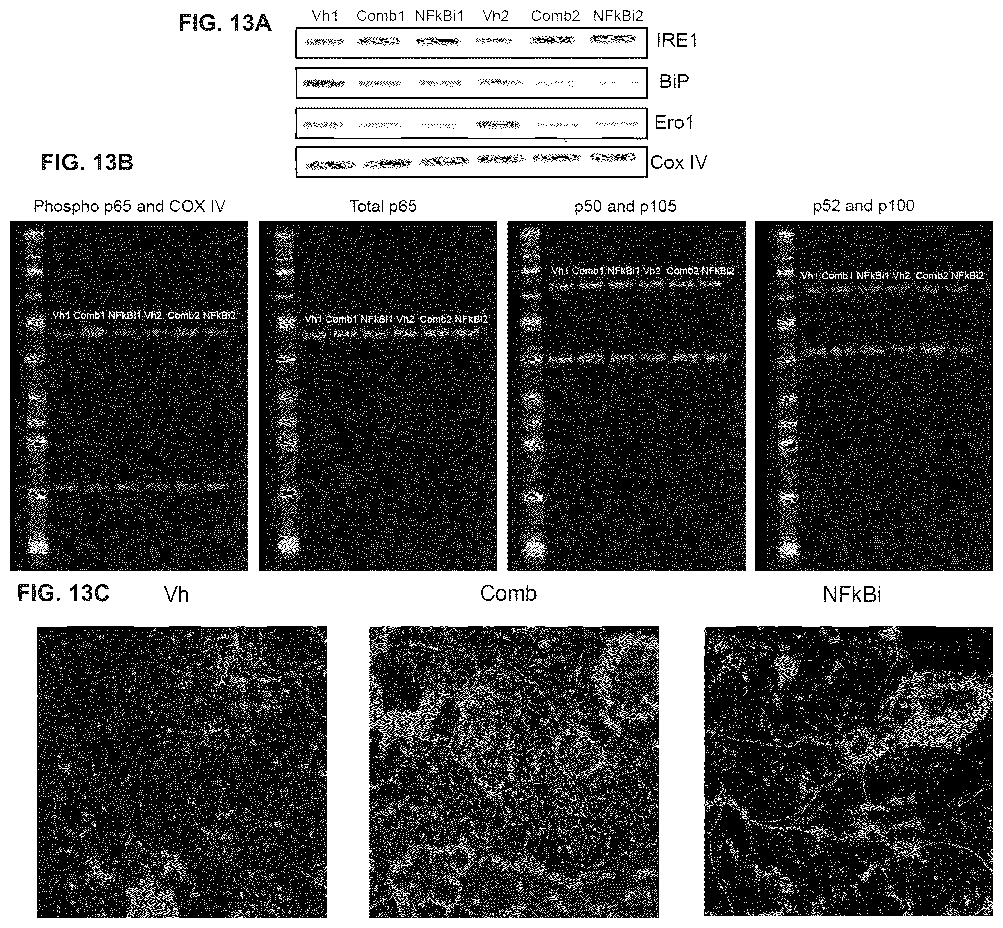 Patent US12378528 Figure 16 – Systems and methods for growth of intestinal cells in microfluidic devices