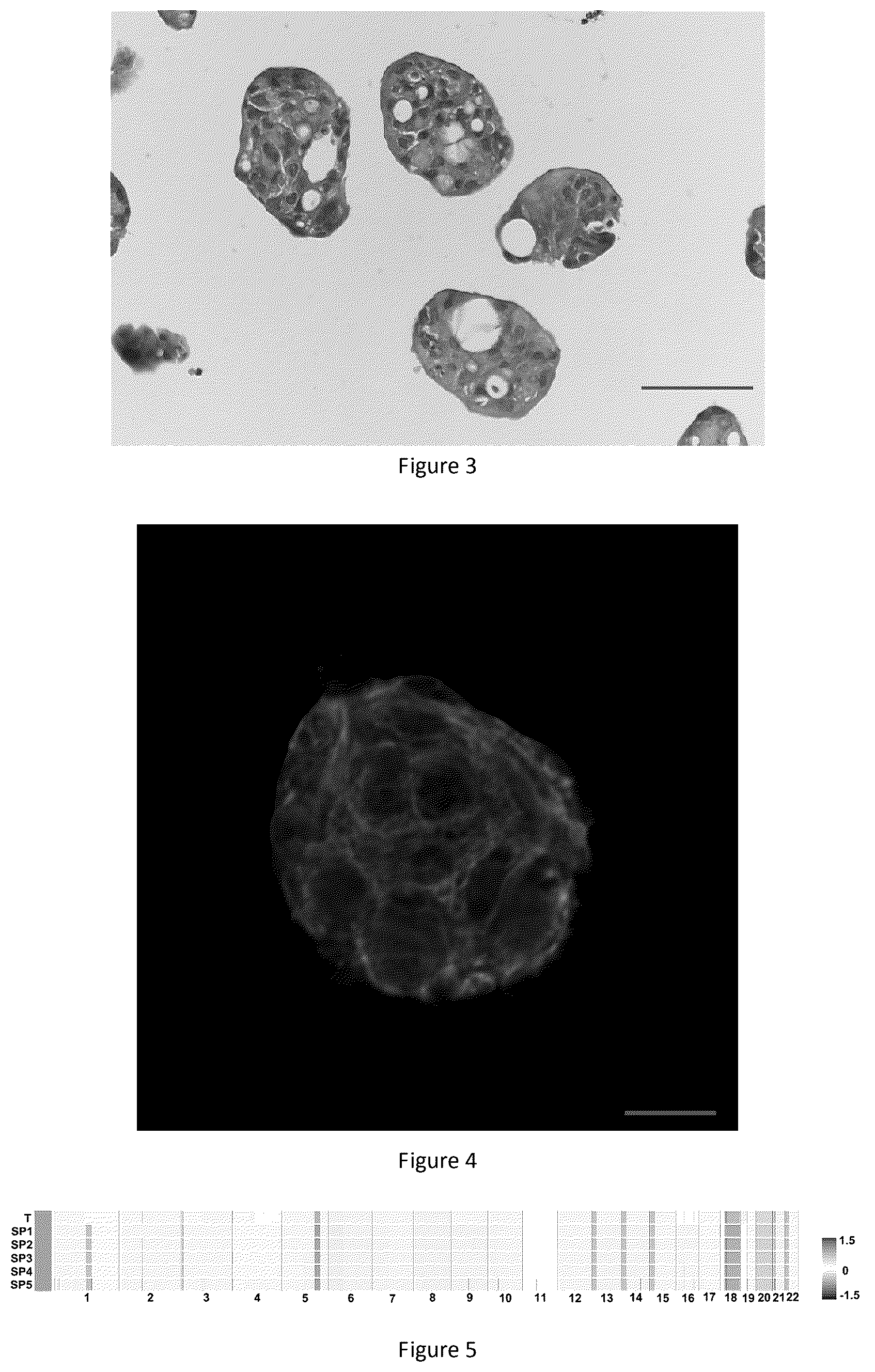 Patent US12378529 Figure 2 – Method for culturing colorectal cancer solid tumor primary cells and colorectal cancer ascites primary tumor cells and supporting reagents