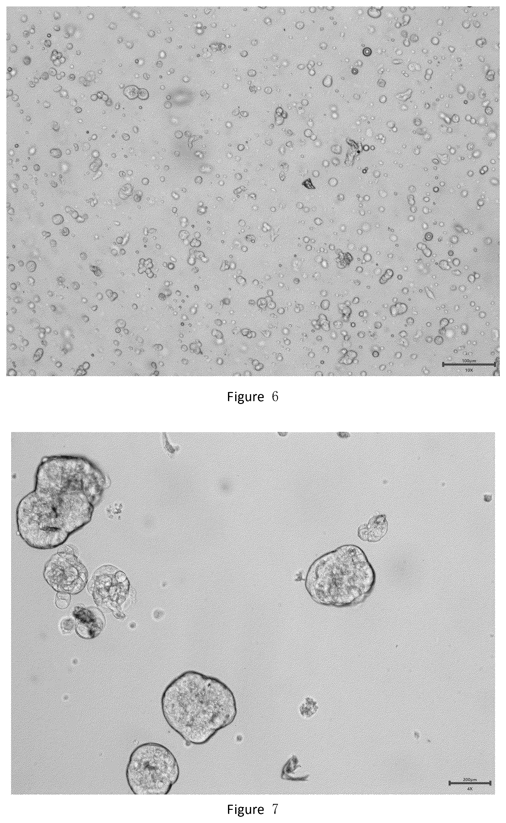 Patent US12378529 Figure 3 – Method for culturing colorectal cancer solid tumor primary cells and colorectal cancer ascites primary tumor cells and supporting reagents