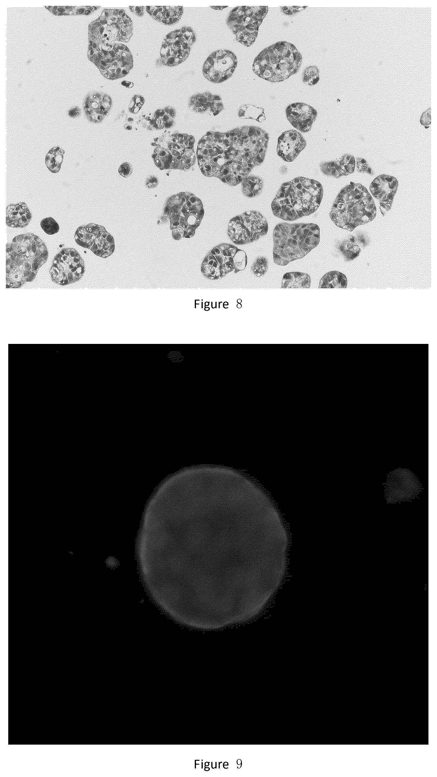Patent US12378529 Figure 4 – Method for culturing colorectal cancer solid tumor primary cells and colorectal cancer ascites primary tumor cells and supporting reagents