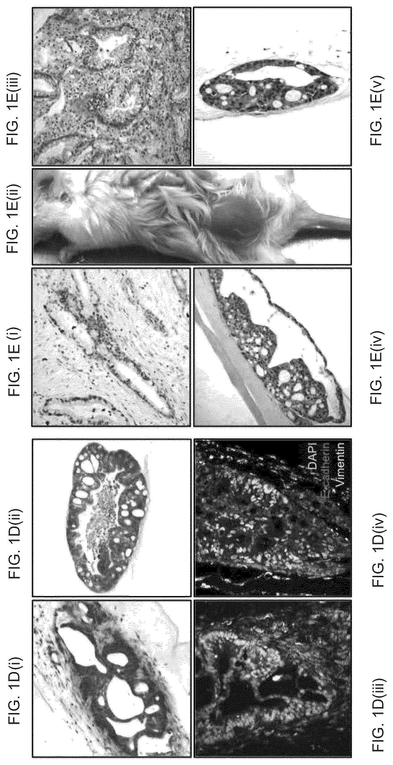Patent US12378530 Figure 2 – Methods to preserve tumor-stromal interactions in culture and therapeutic predictive applications thereof