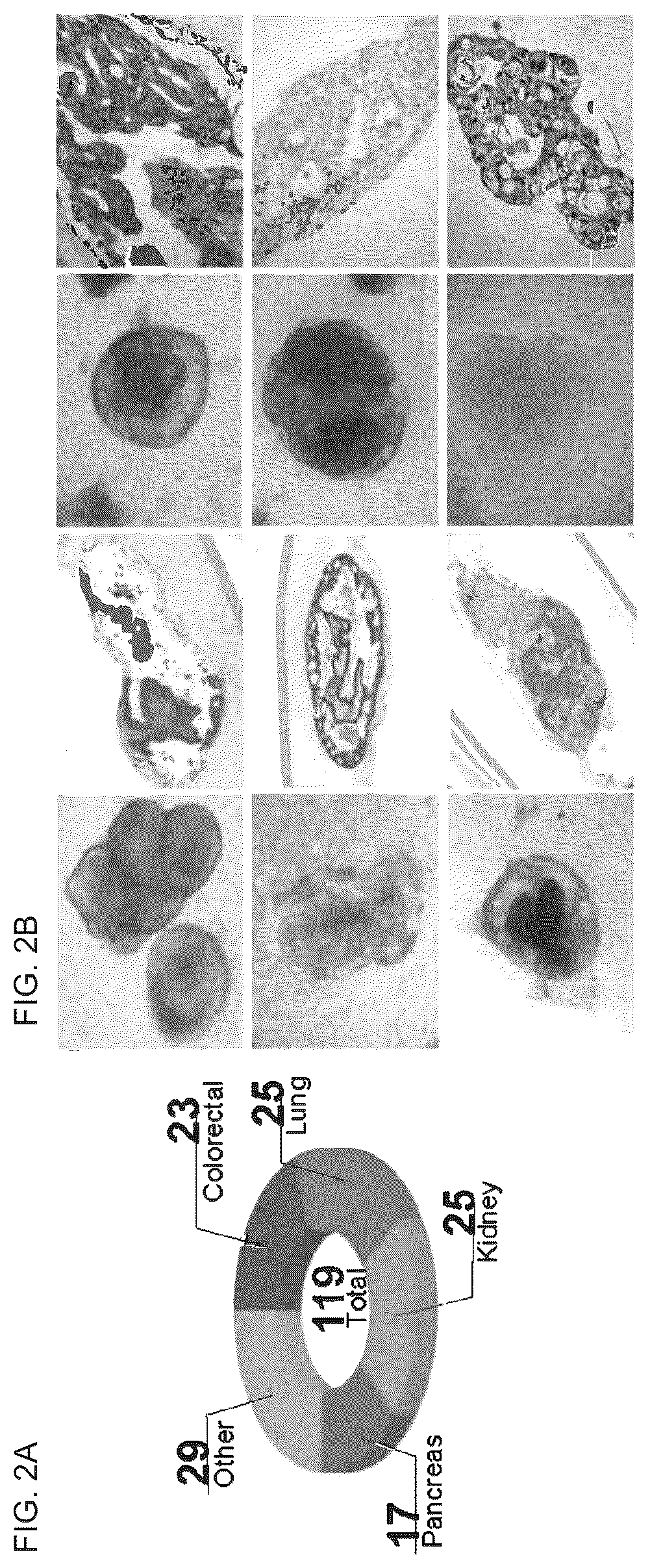 Patent US12378530 Figure 3 – Methods to preserve tumor-stromal interactions in culture and therapeutic predictive applications thereof