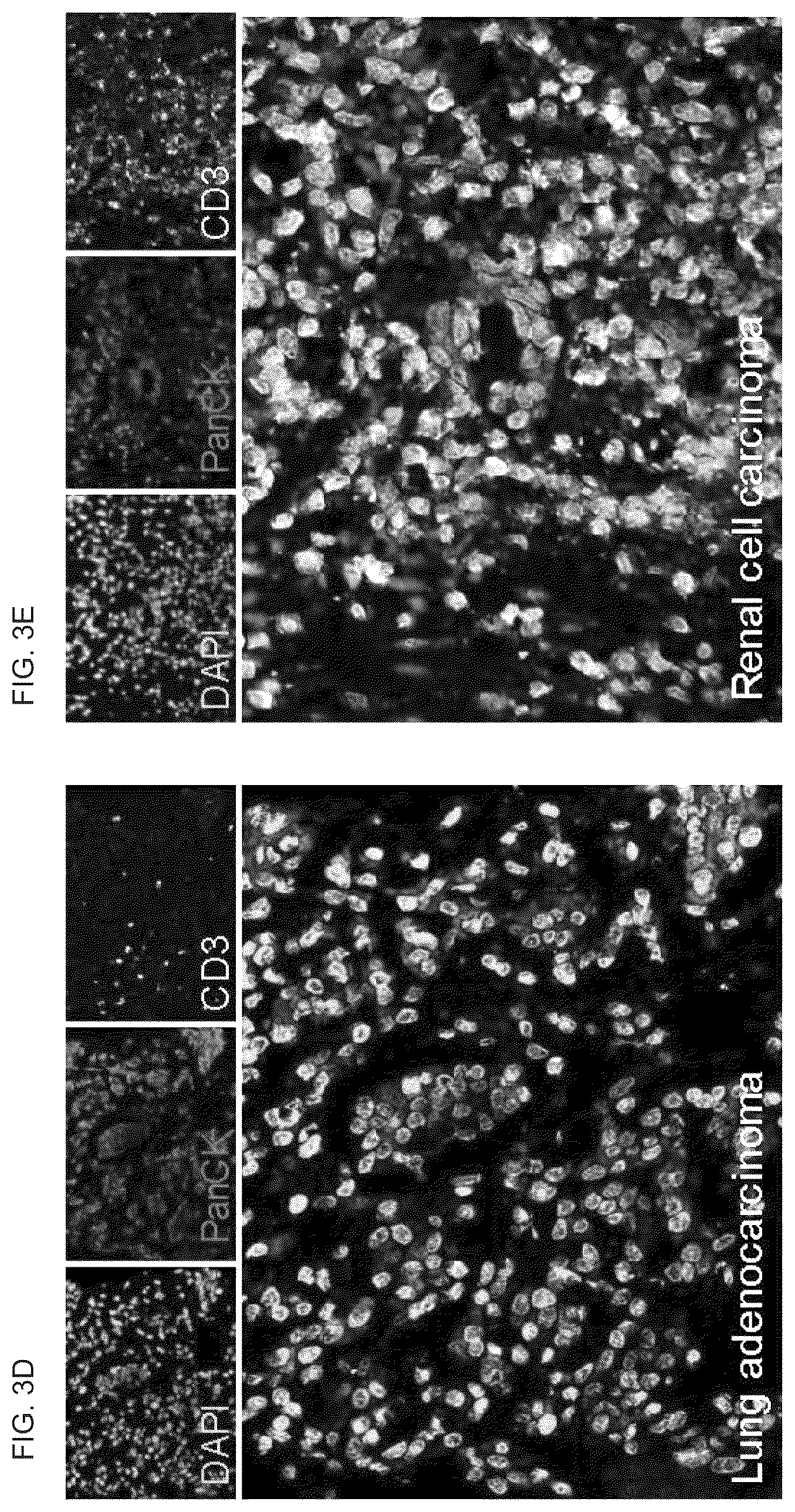 Patent US12378530 Figure 7 – Methods to preserve tumor-stromal interactions in culture and therapeutic predictive applications thereof