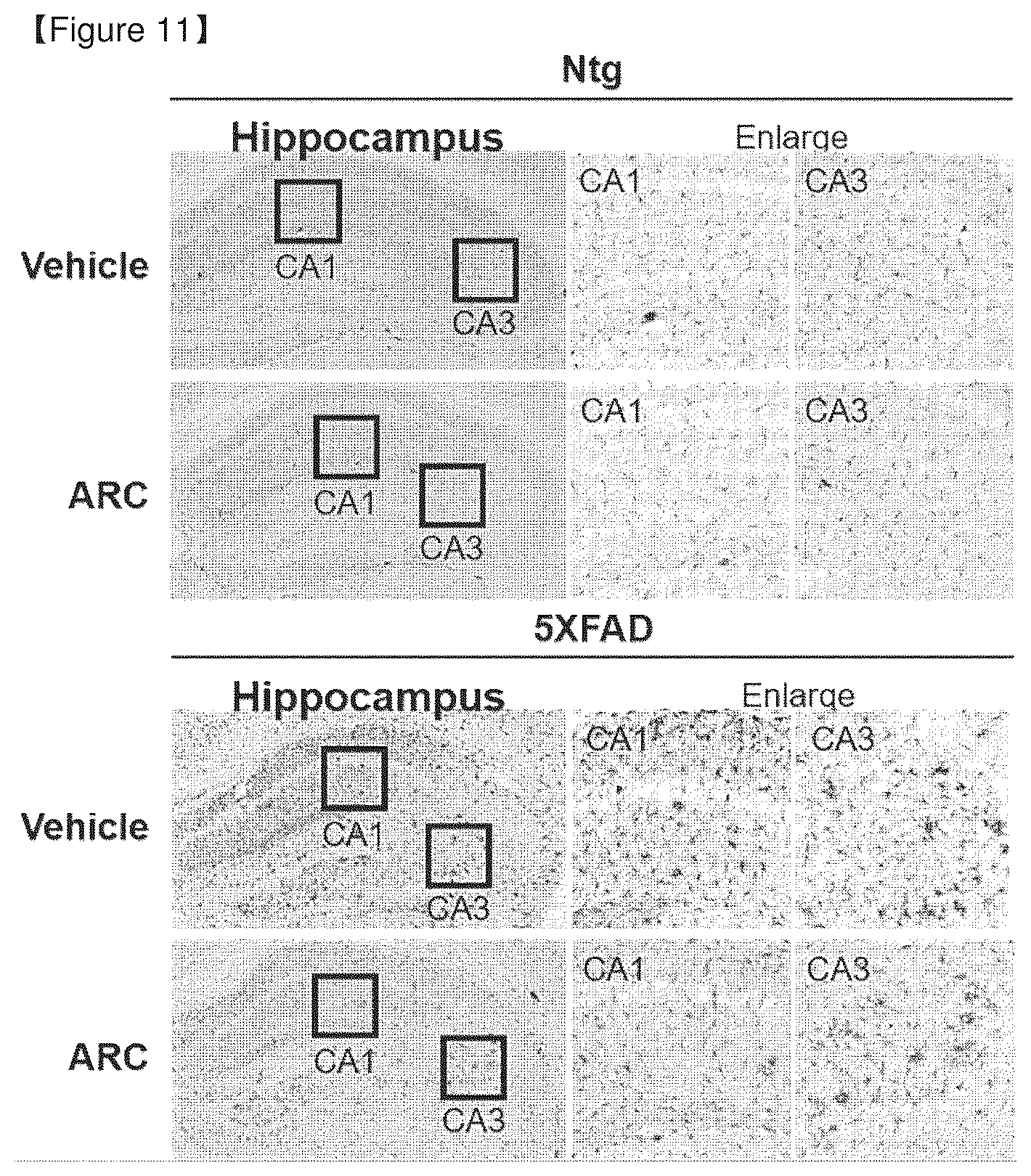Patent US12378532 Figure 6 – Food composition containing novel aldehyde dehydrogenase for improving memory and cognitive function