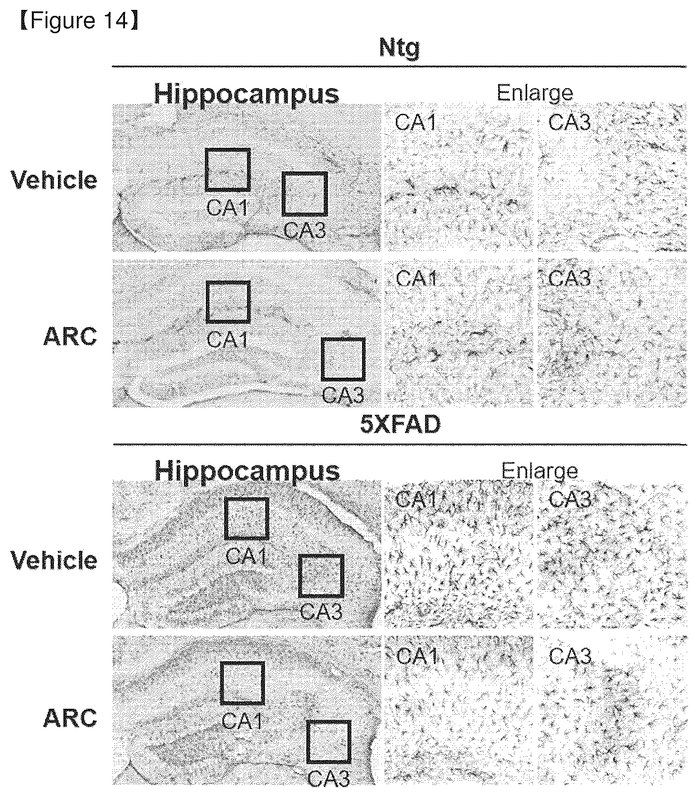 Patent US12378532 Figure 8 – Food composition containing novel aldehyde dehydrogenase for improving memory and cognitive function