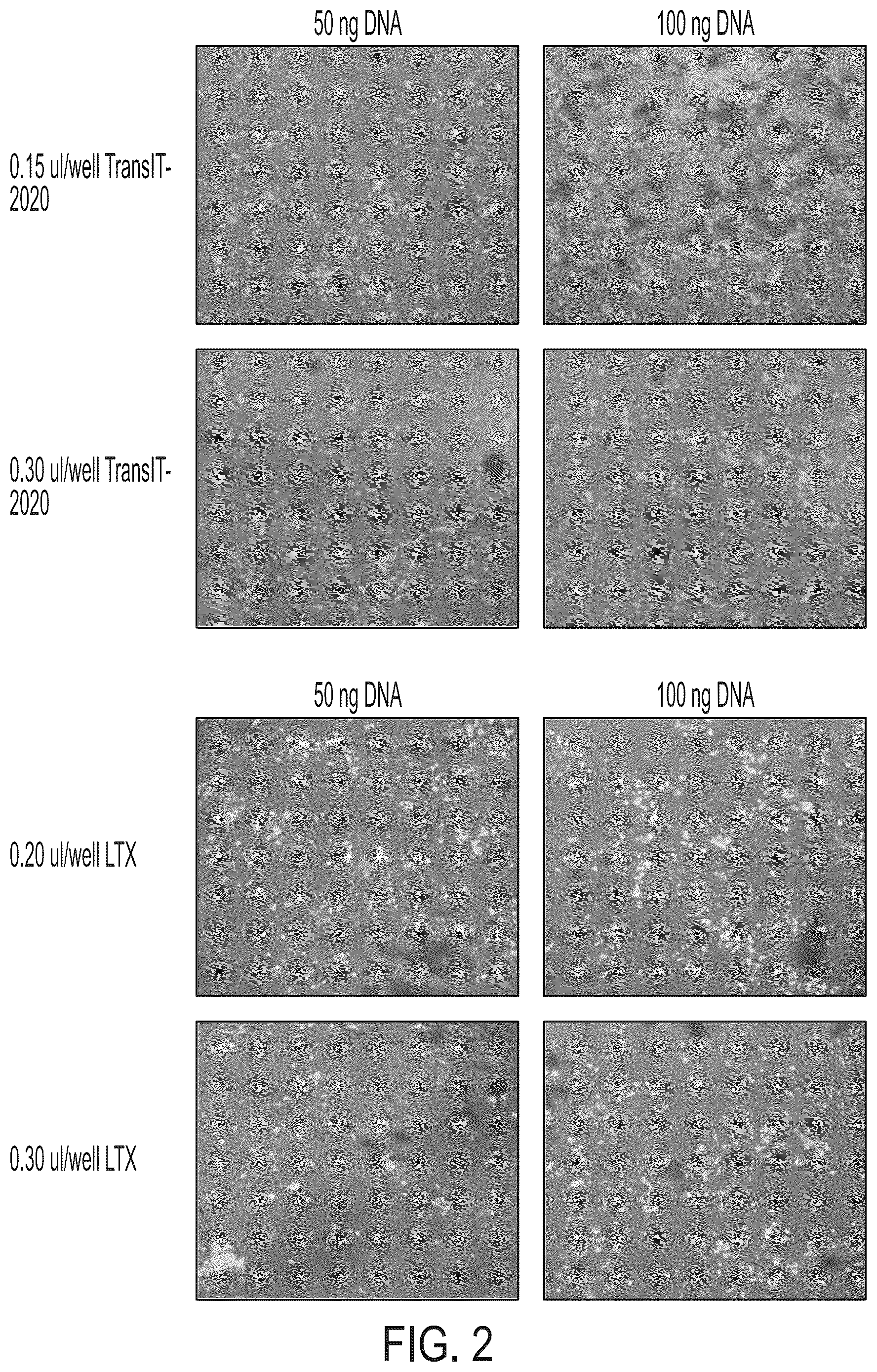 Patent US12378556 Figure 5 – Treatment of angiopoietin like 7 (ANGPTL7) related diseases
