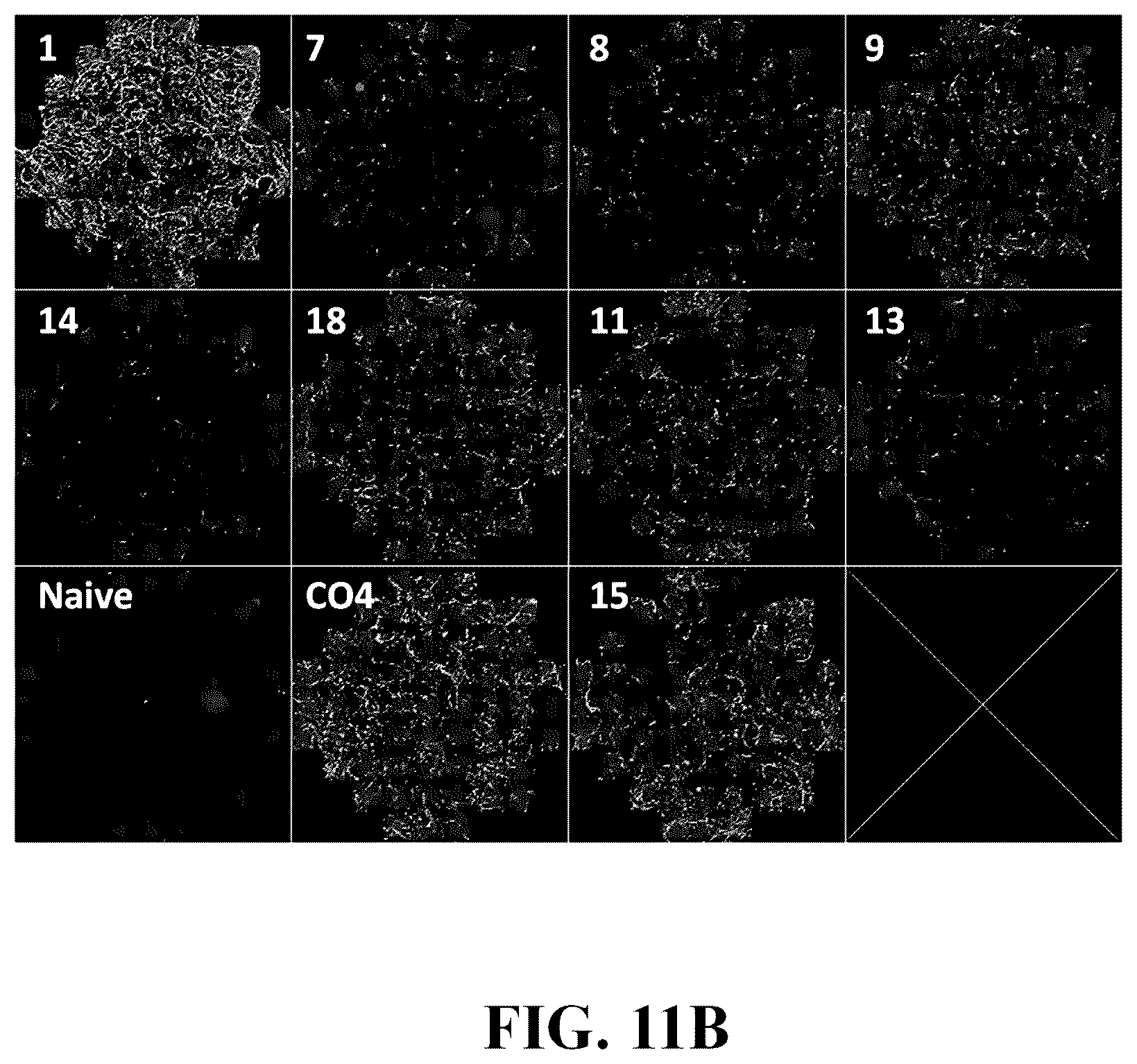 Patent US12378576 Figure 16 – Gene therapy for CNS degeneration
