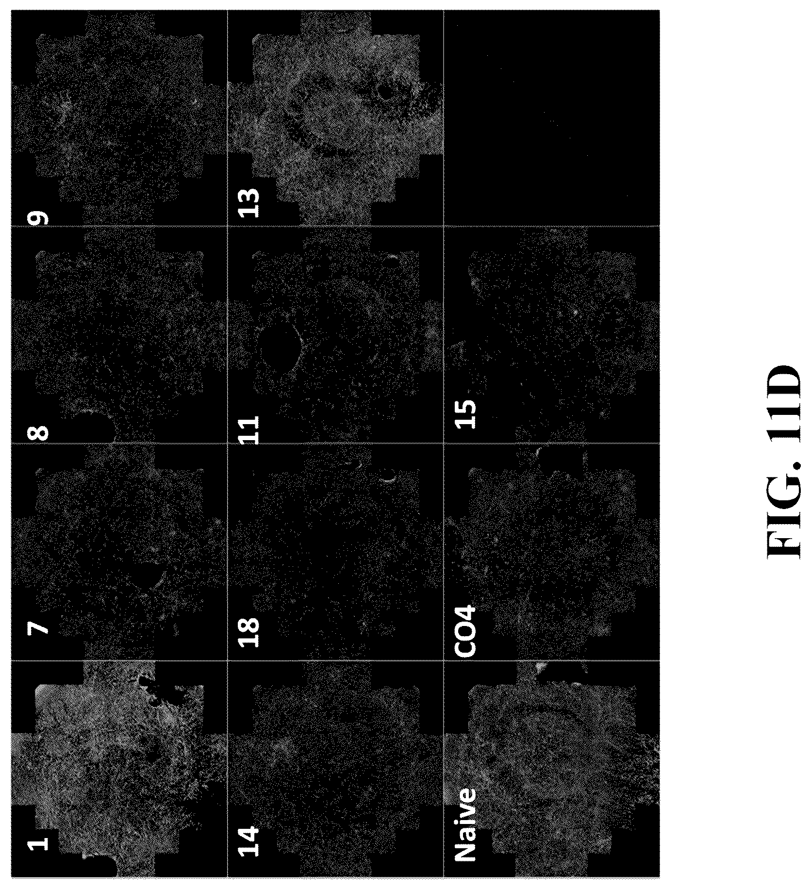 Patent US12378576 Figure 18 – Gene therapy for CNS degeneration