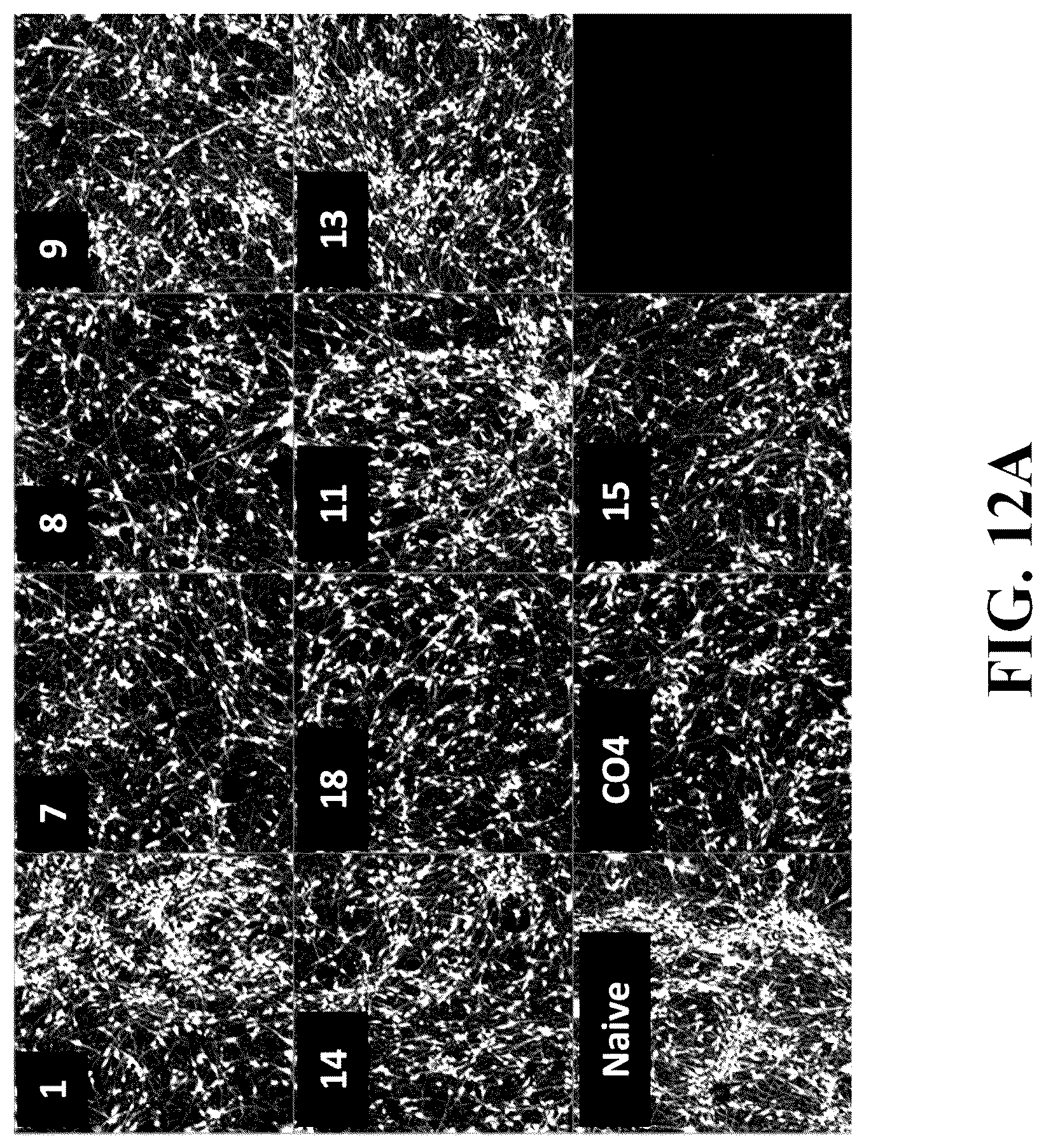 Patent US12378576 Figure 19 – Gene therapy for CNS degeneration