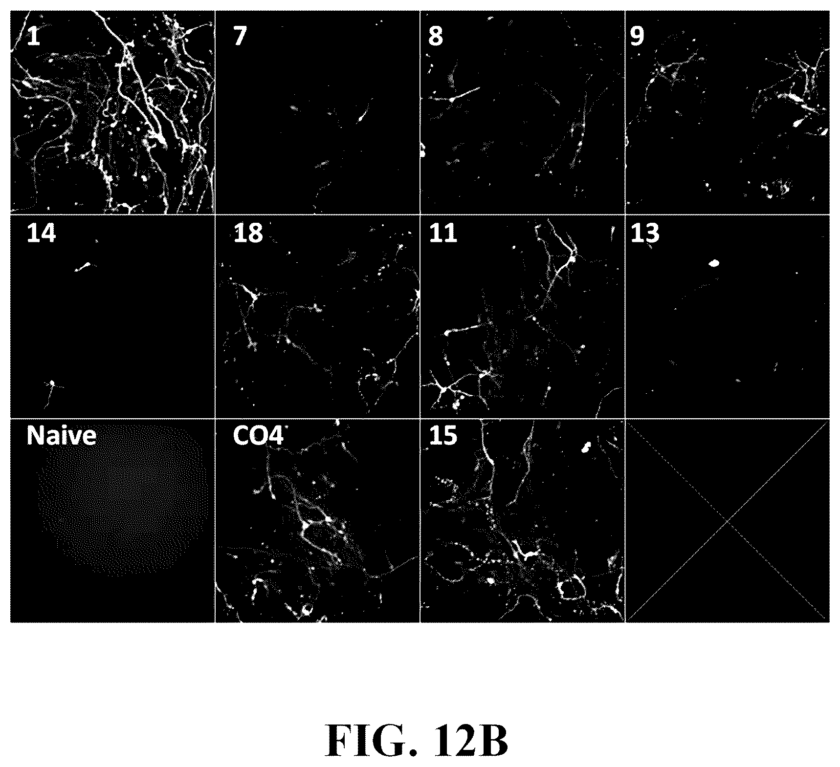Patent US12378576 Figure 20 – Gene therapy for CNS degeneration