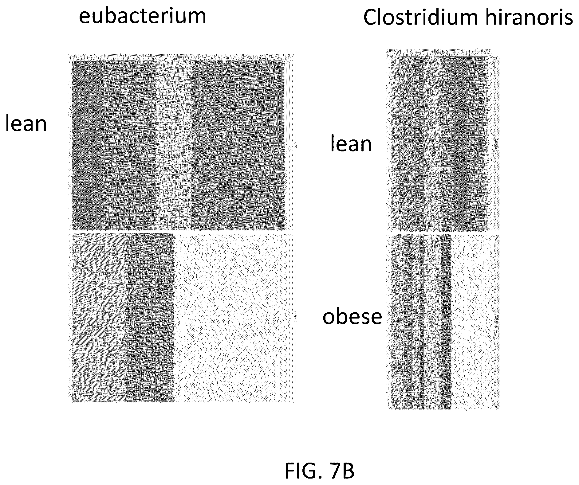 Patent US12378611 Figure 15 – Microbiome markers and uses thereof