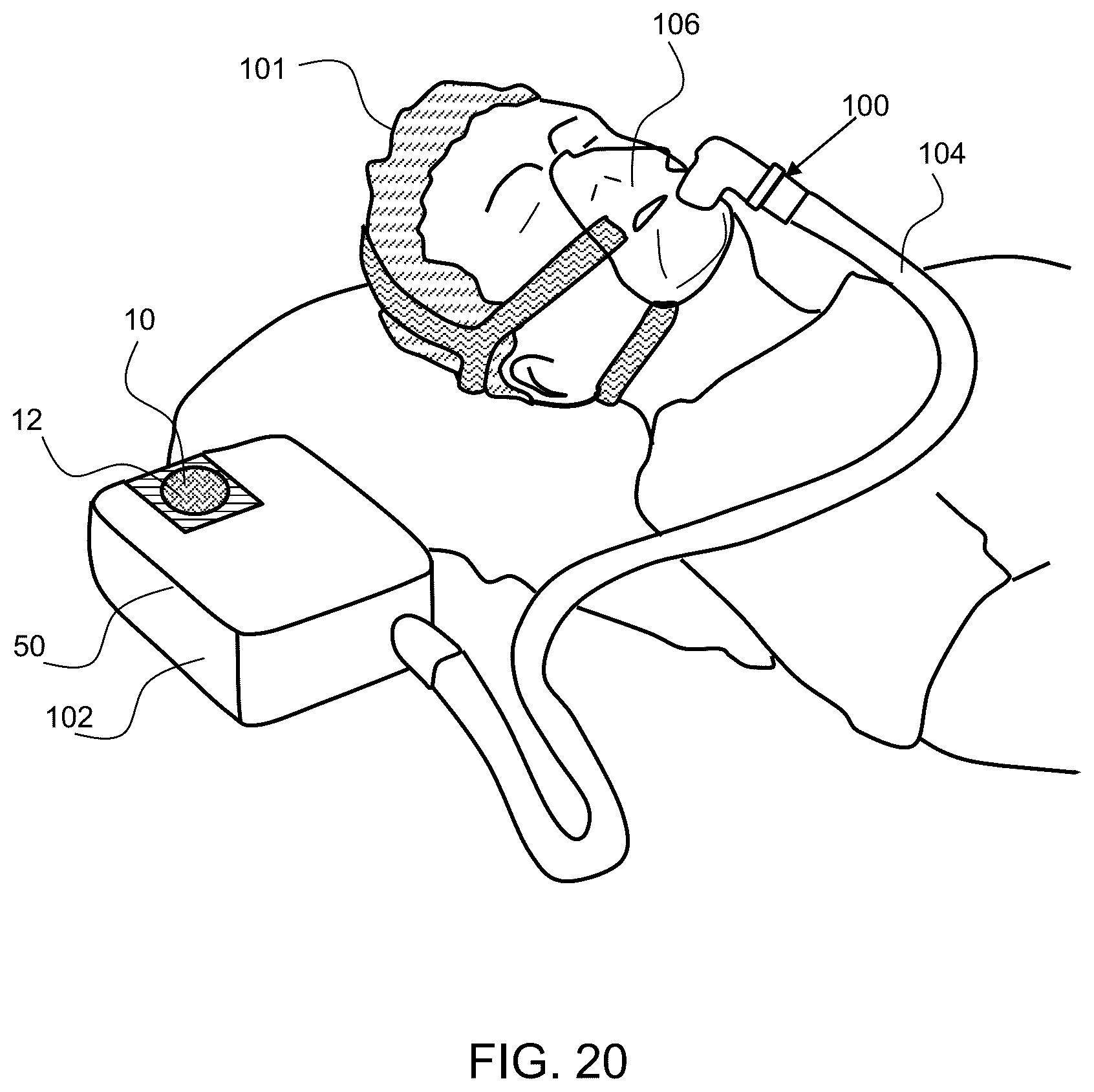 Patent US12378682 Figure 16 – Electrolysis cell assembly utilizing an anion exchange membrane