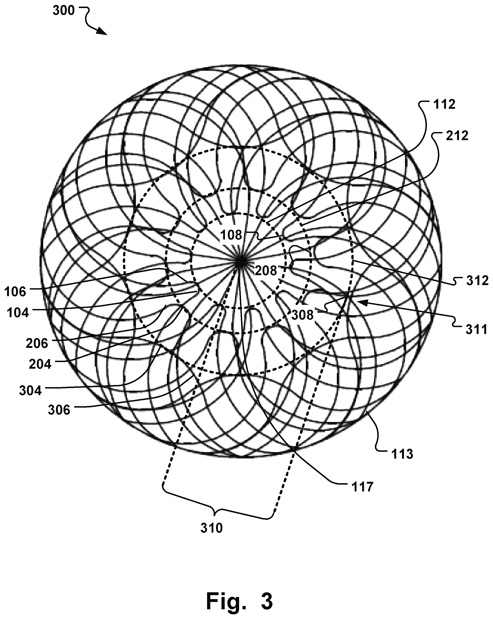 Patent US12378709 Figure 3 – Braided medical device and manufacturing method thereof