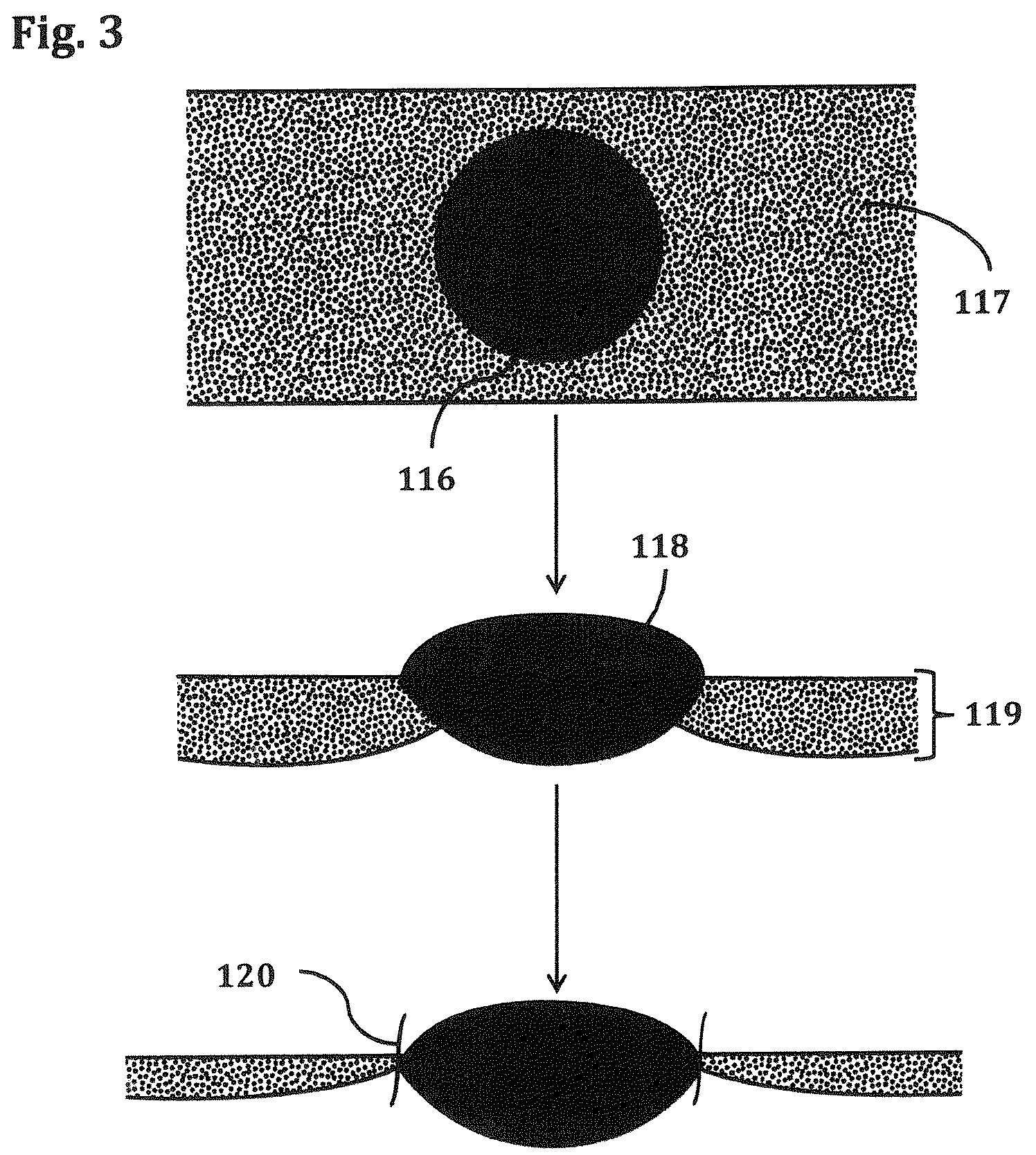 Patent US12378725 Figure 3 – Percolative surface textured polymeric latex coating for a fabric supported glove and method of making