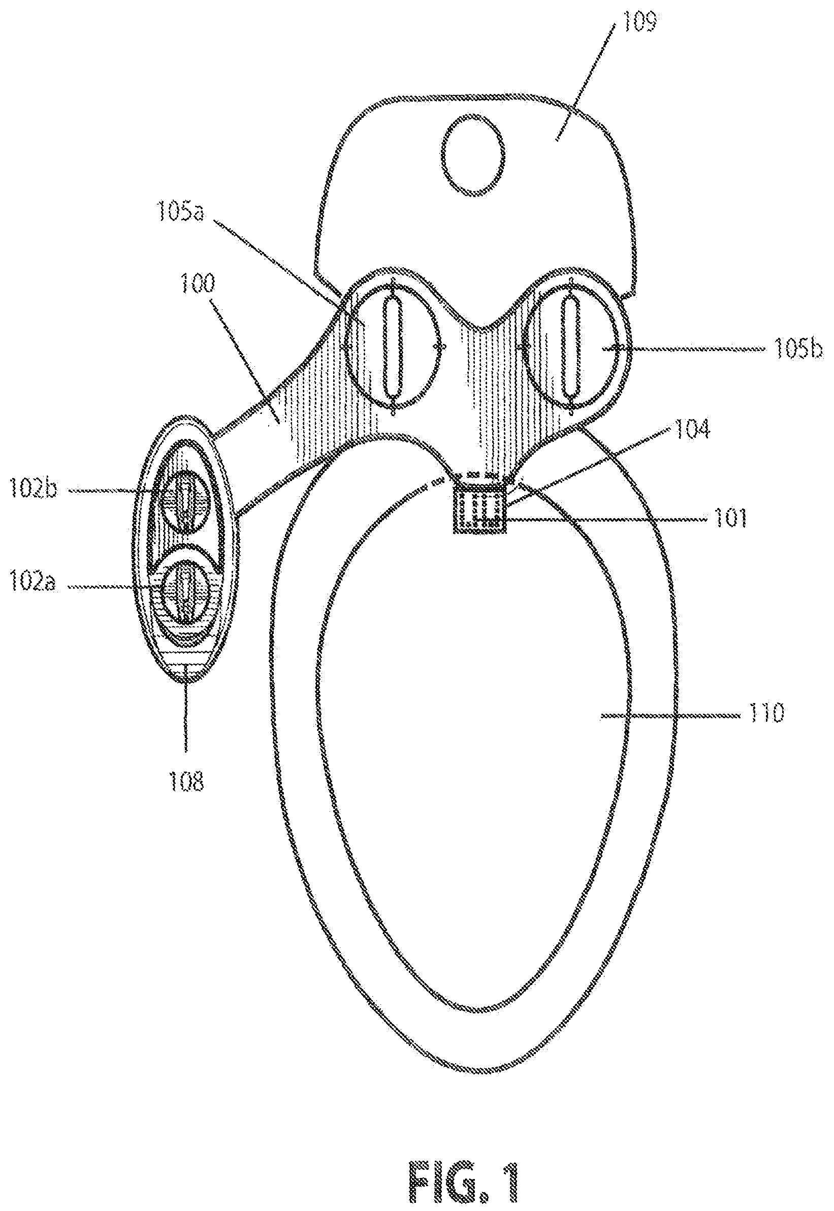 Patent US12378756 Figure 1 – Bidet washing apparatus with disinfectant wash feature
