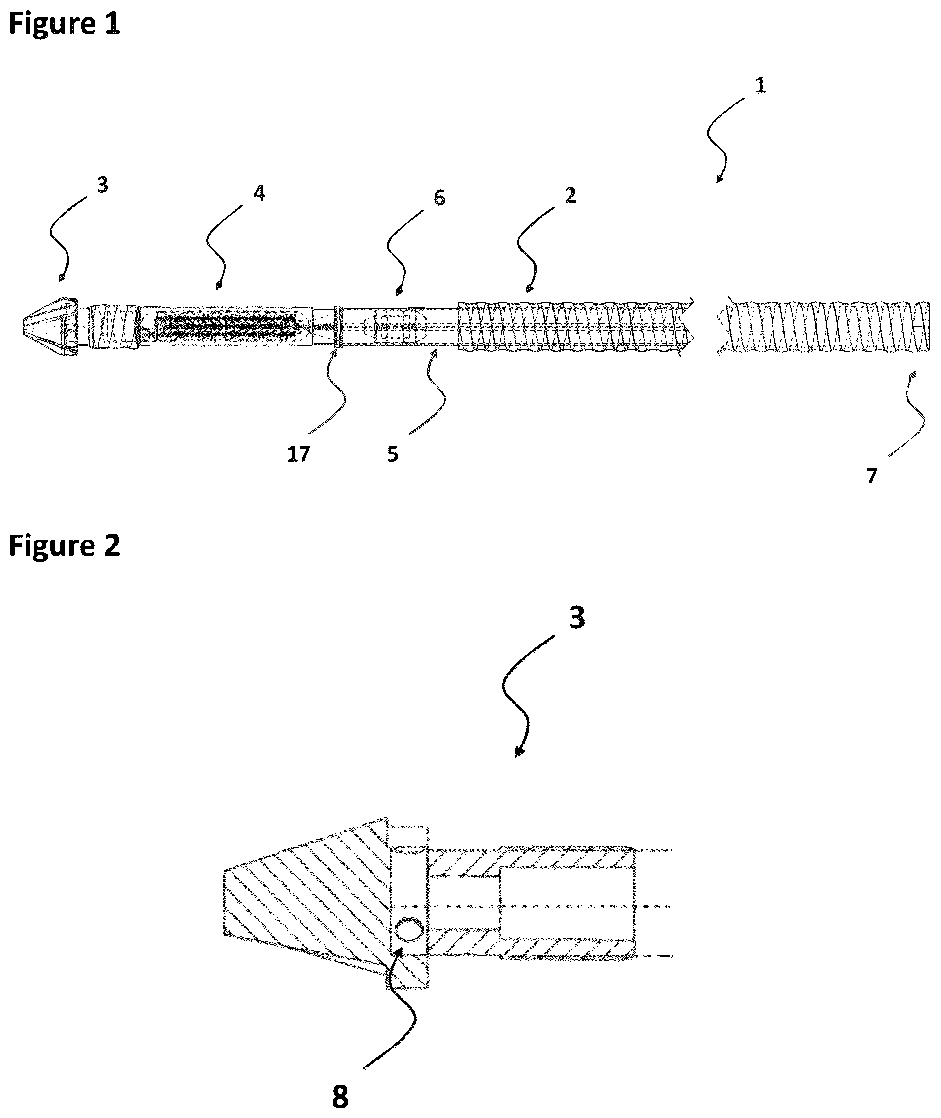 Patent US12378886 Figure 1 – Hollow rod composite anchor with improved setting capability and method for setting a hollow rod composite anchor into a rock stratum