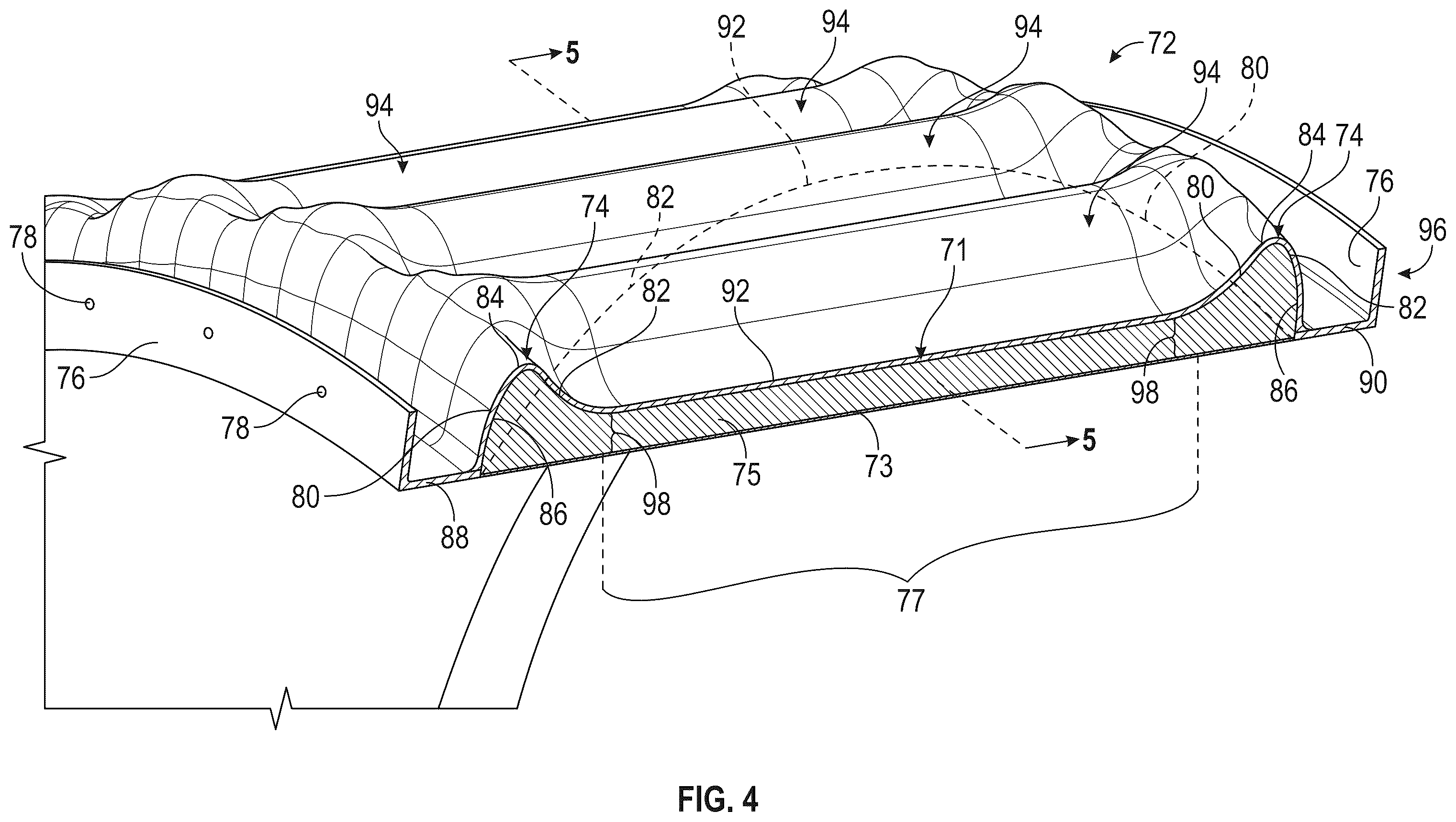 Patent US12378896 Figure 4 – Containment ring for gas turbine engine