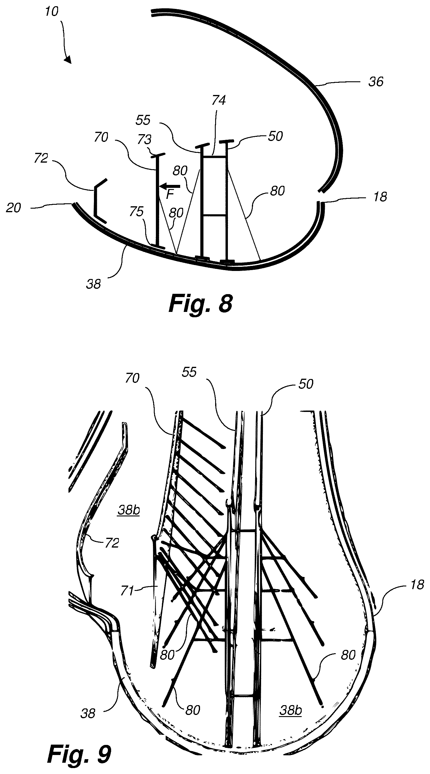 Patent US12378944 Figure 5 – Method of supporting shear webs of a wind turbine blade