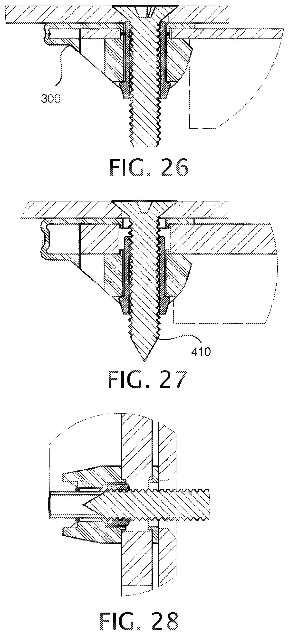 Patent US12378987 Figure 5 – Expandable collet bodies with sectional finger-based anti-rotation feature, clips inserts and systems thereof