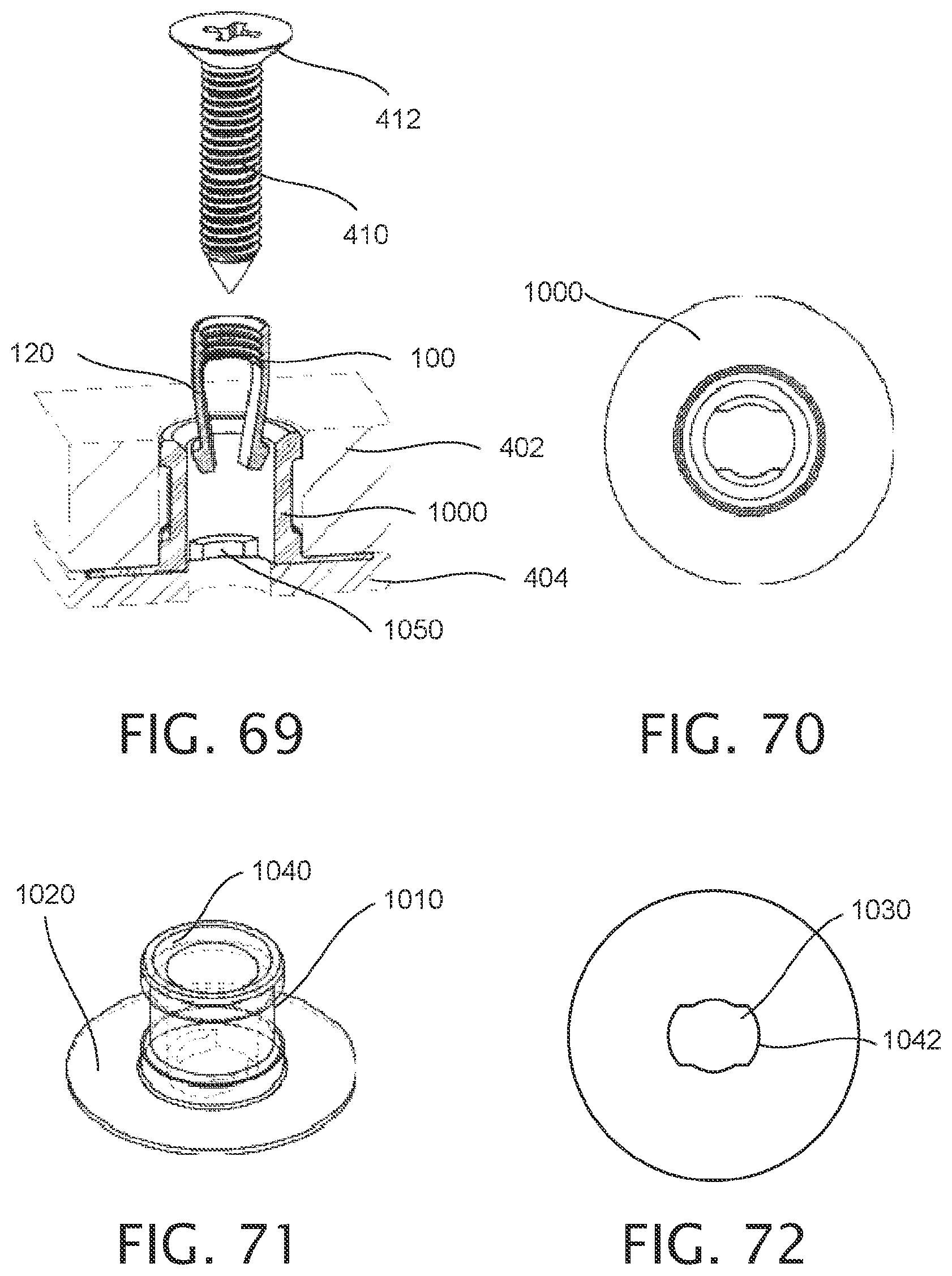 Patent US12378987 Figure 17 – Expandable collet bodies with sectional finger-based anti-rotation feature, clips inserts and systems thereof