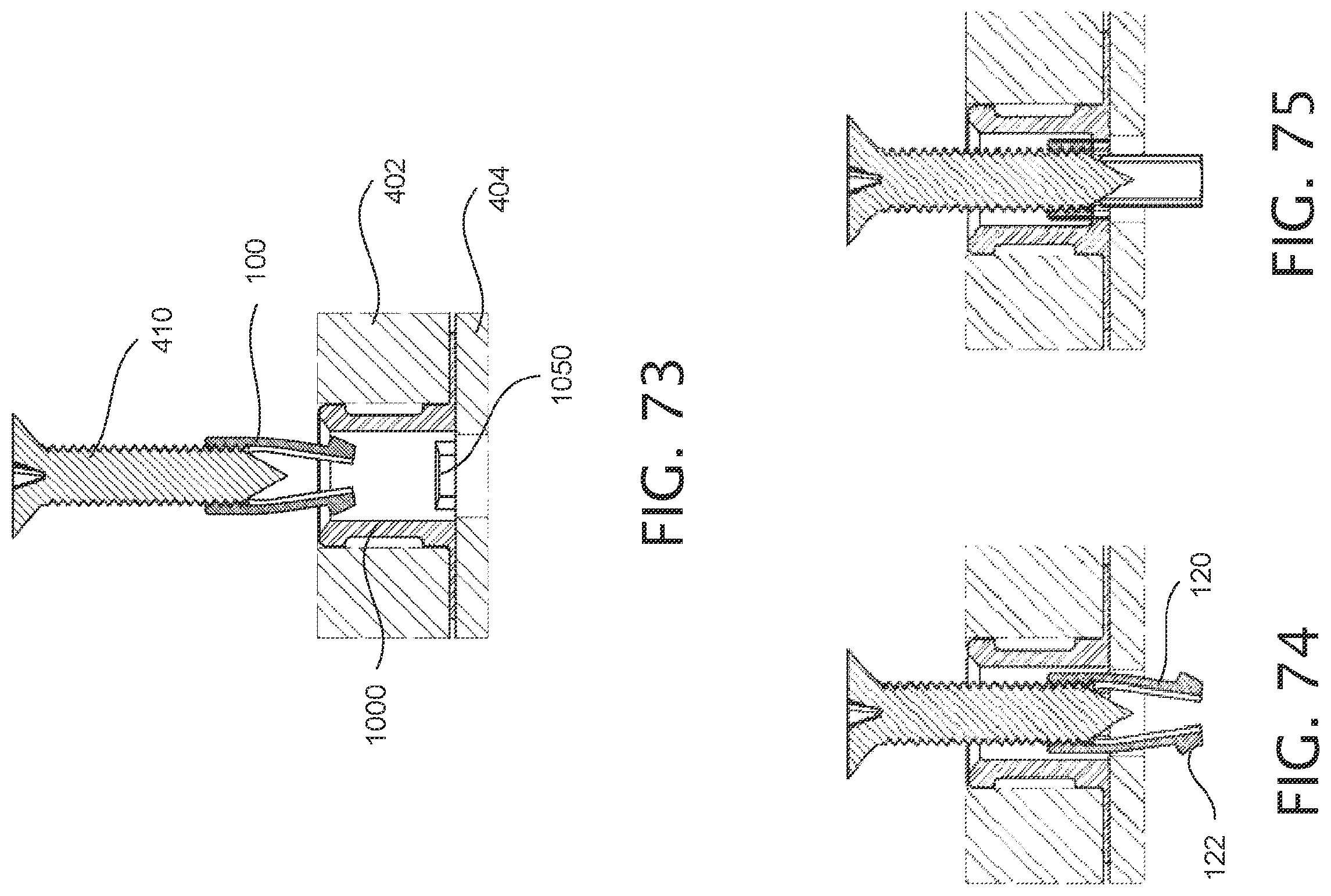 Patent US12378987 Figure 18 – Expandable collet bodies with sectional finger-based anti-rotation feature, clips inserts and systems thereof