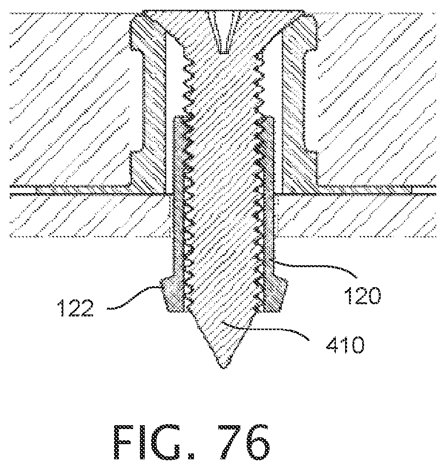 Patent US12378987 Figure 19 – Expandable collet bodies with sectional finger-based anti-rotation feature, clips inserts and systems thereof