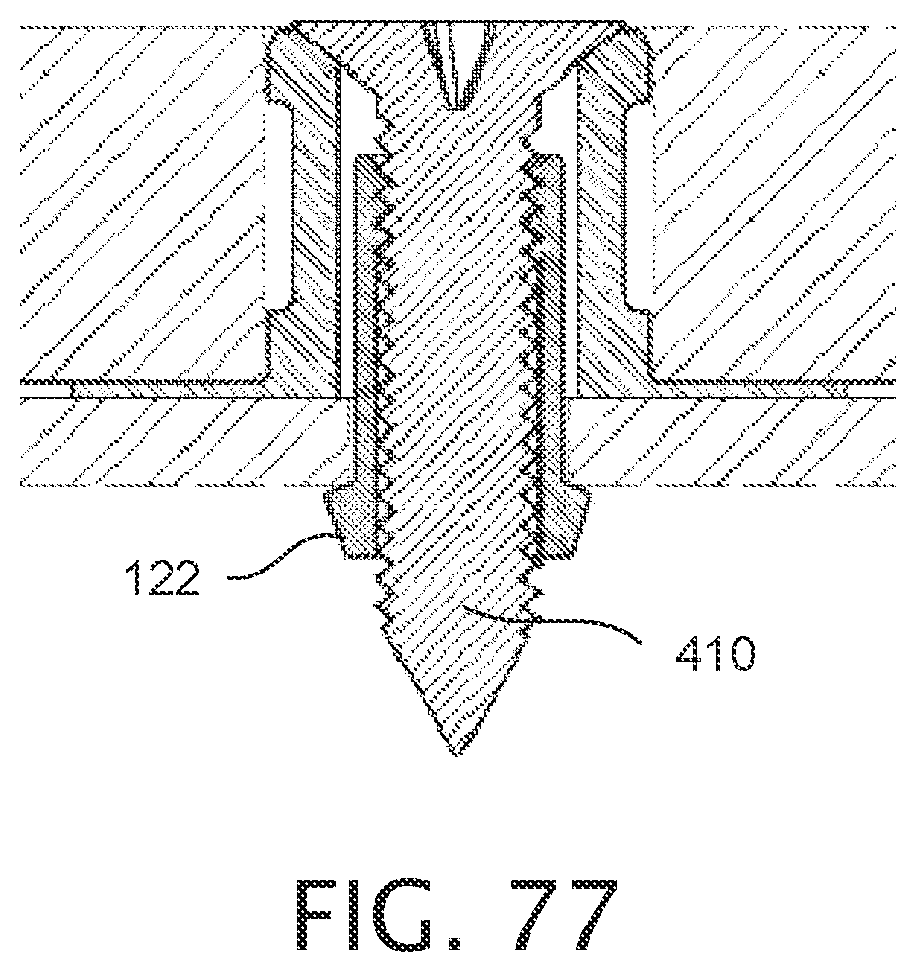 Patent US12378987 Figure 20 – Expandable collet bodies with sectional finger-based anti-rotation feature, clips inserts and systems thereof