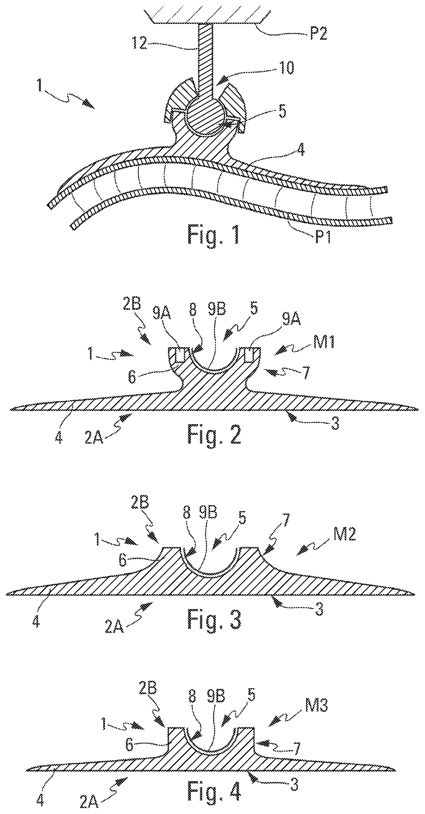Patent US12378989 Figure 1 – Partially polymerised thermohardenable connection part and methods for producing and assembling such a connection part