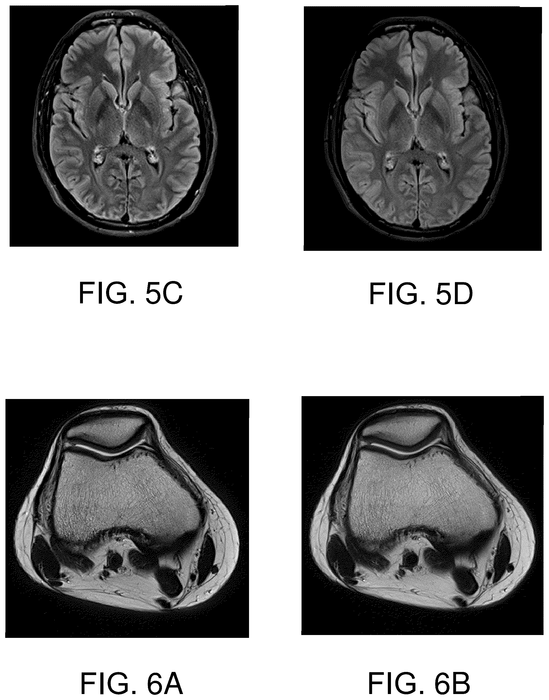 Patent US12386003 Figure 5 – Magnetic resonance imaging method and apparatus based on two-dimensional fast spin echo