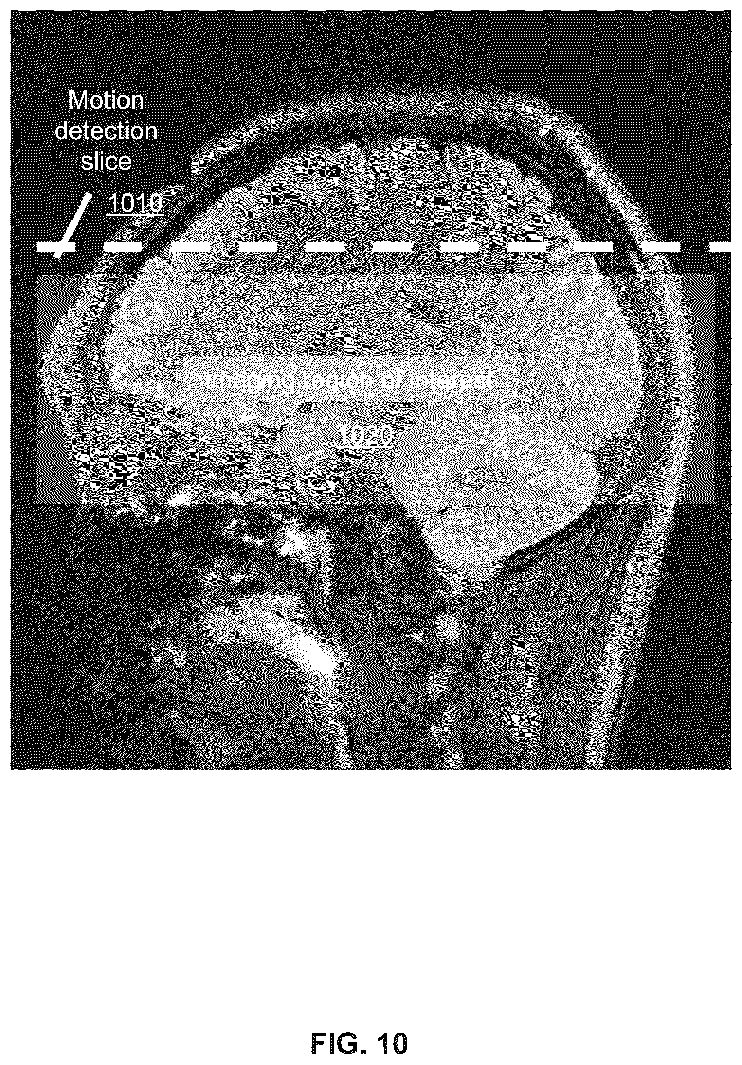 Patent US12386004 Figure 10 – Methods and systems for motion detection in magnetic resonance imaging