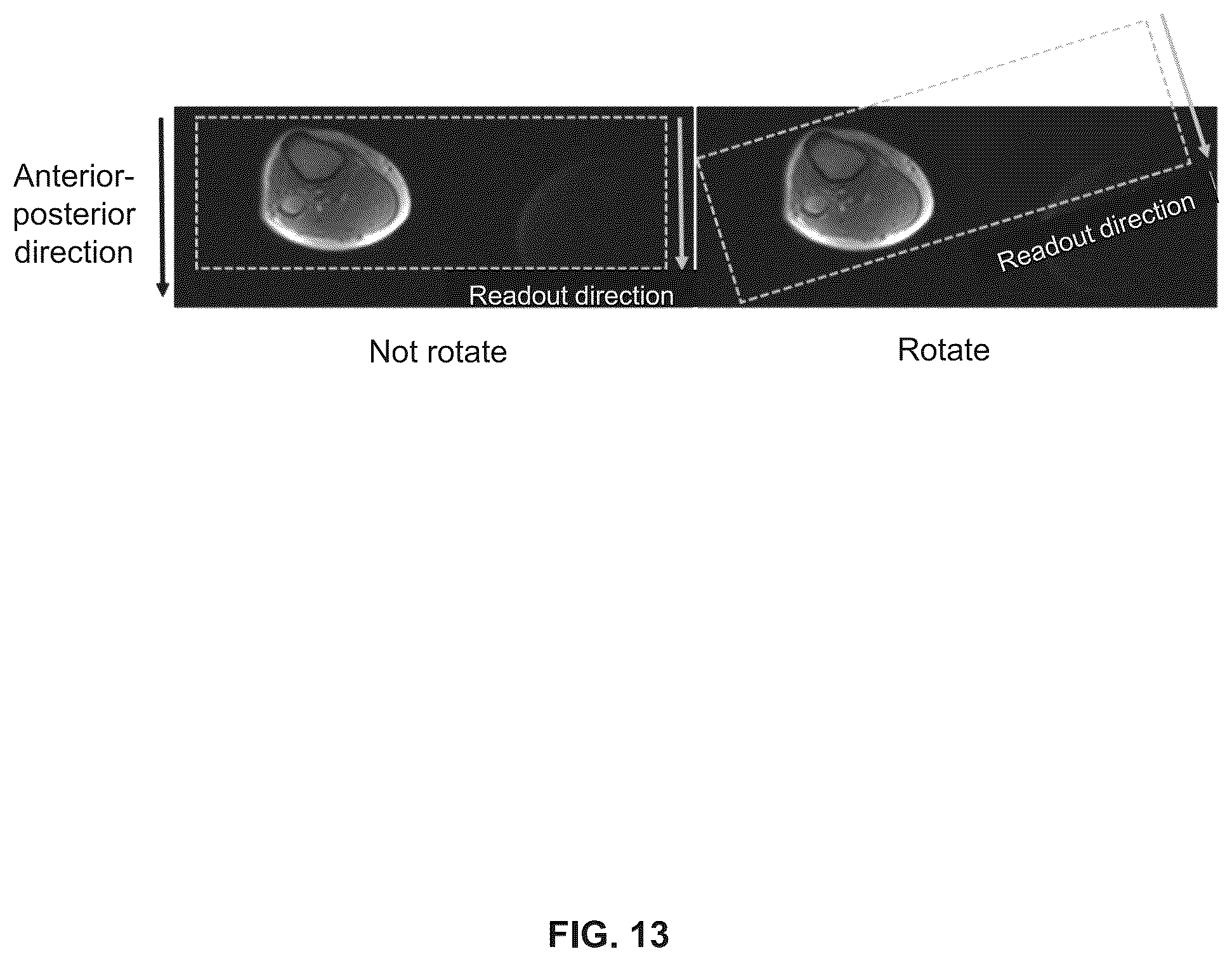 Patent US12386004 Figure 13 – Methods and systems for motion detection in magnetic resonance imaging