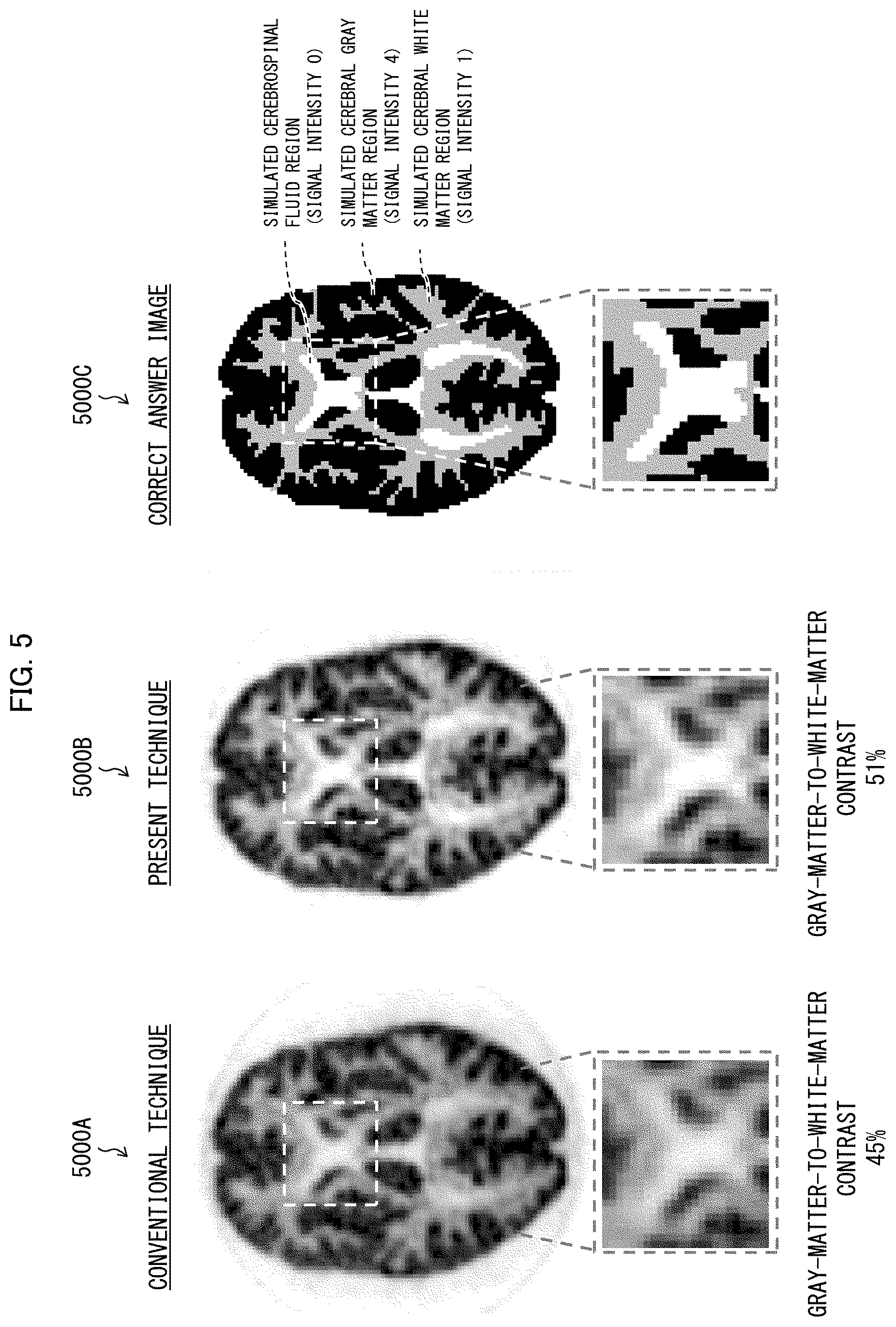 Patent US12386087 Figure 5 – Image processing device, image processing system, and image processing method