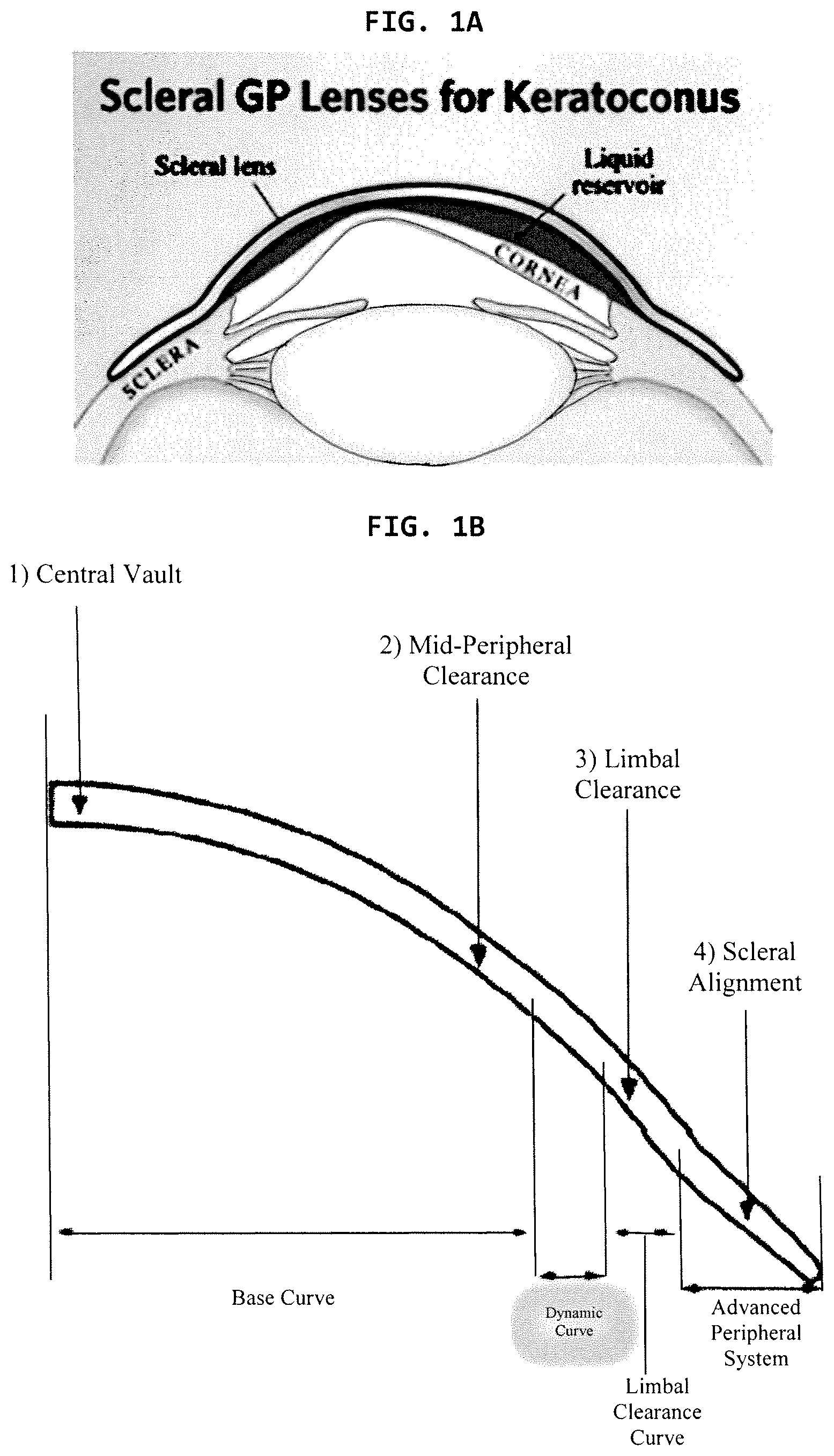Patent US12386200 — Method for obtaining contact lenses with dynamically controlled sagitta and clearance — Figure 1