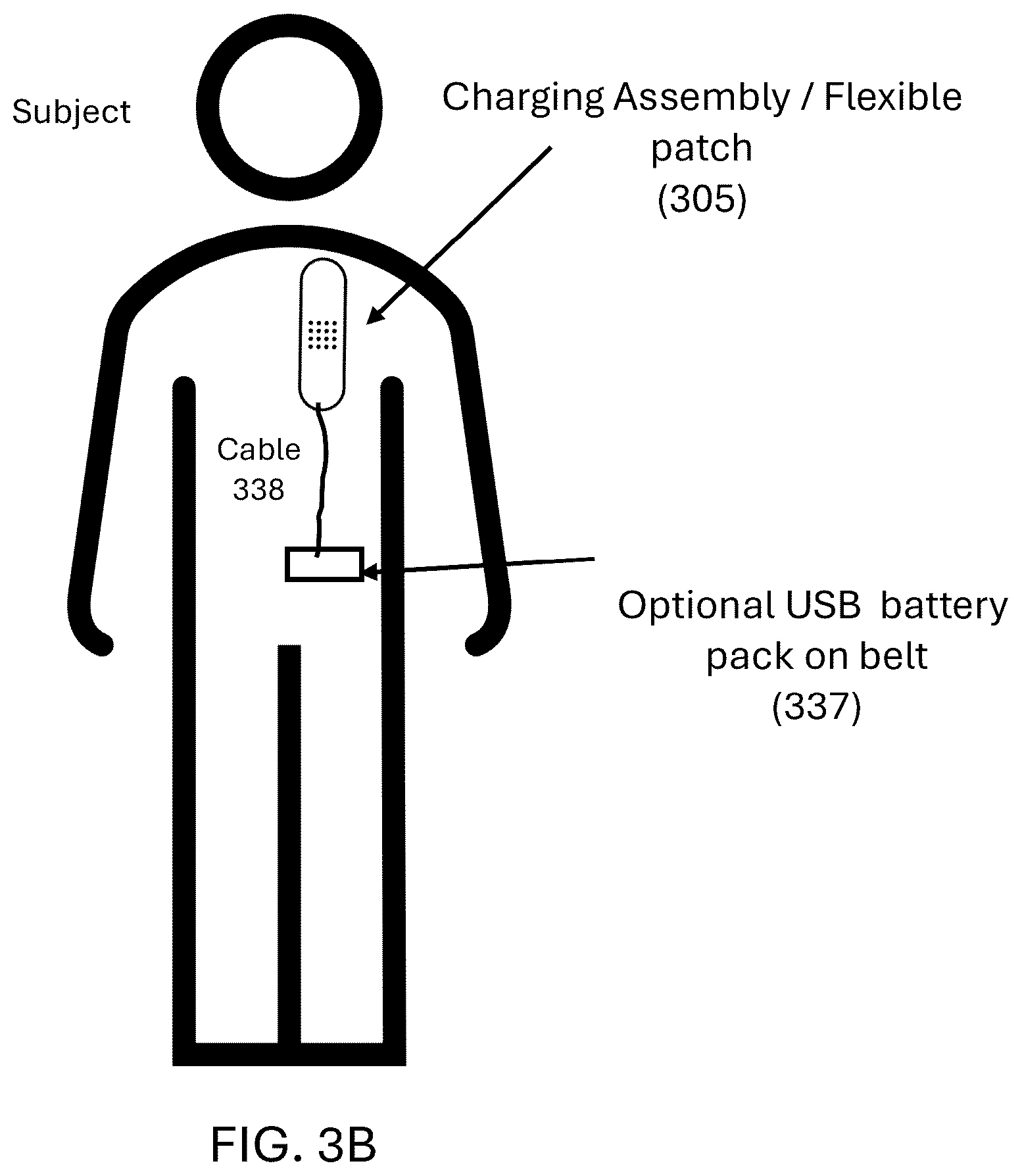 Patent US12395015 Figure 6 – Optical power delivery to implanted medical devices