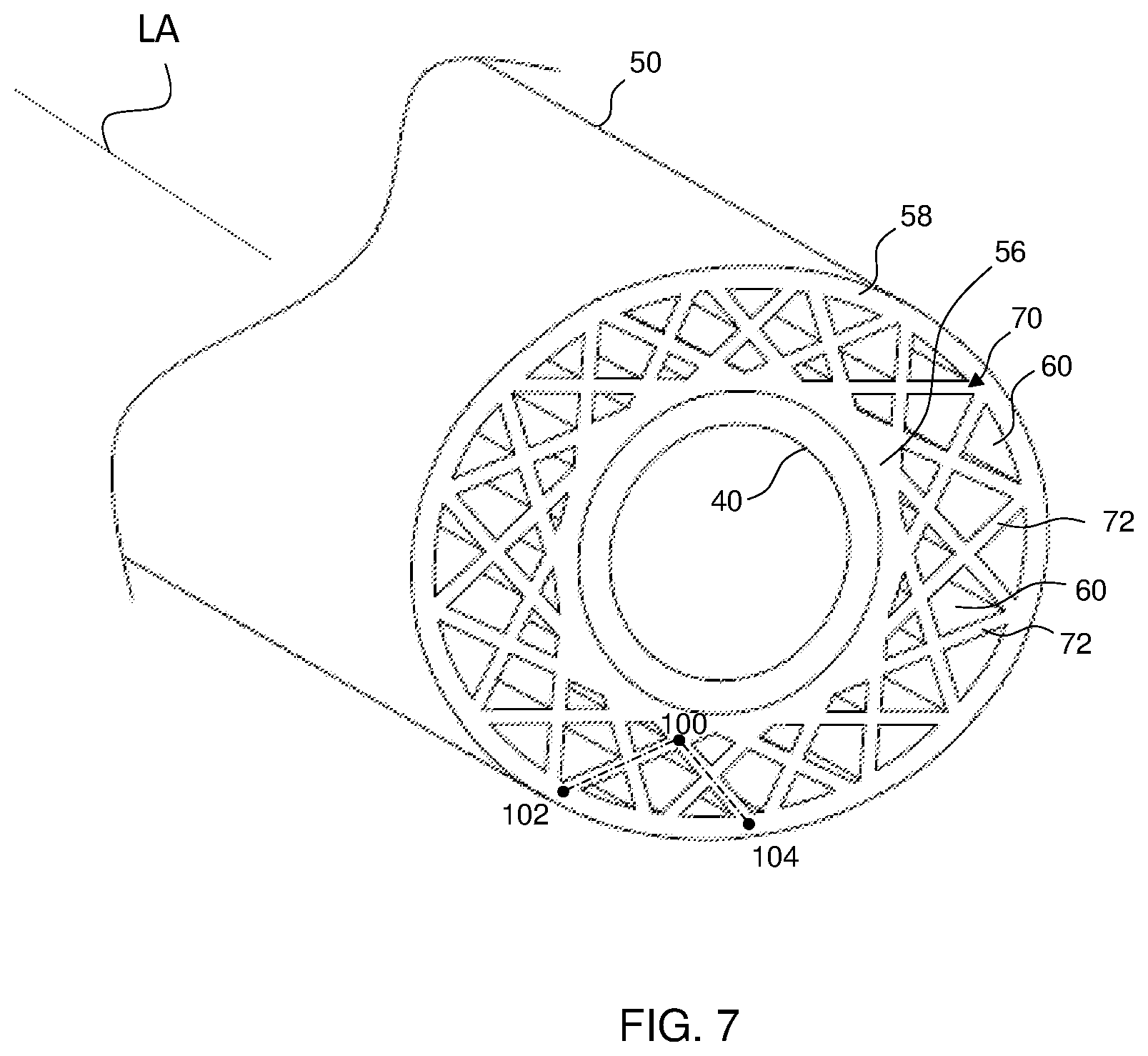 Patent US12396391 Figure 7 – Control grip shape for zero-turn mower, control grip for zero-turn lawnmower, and lawnmower