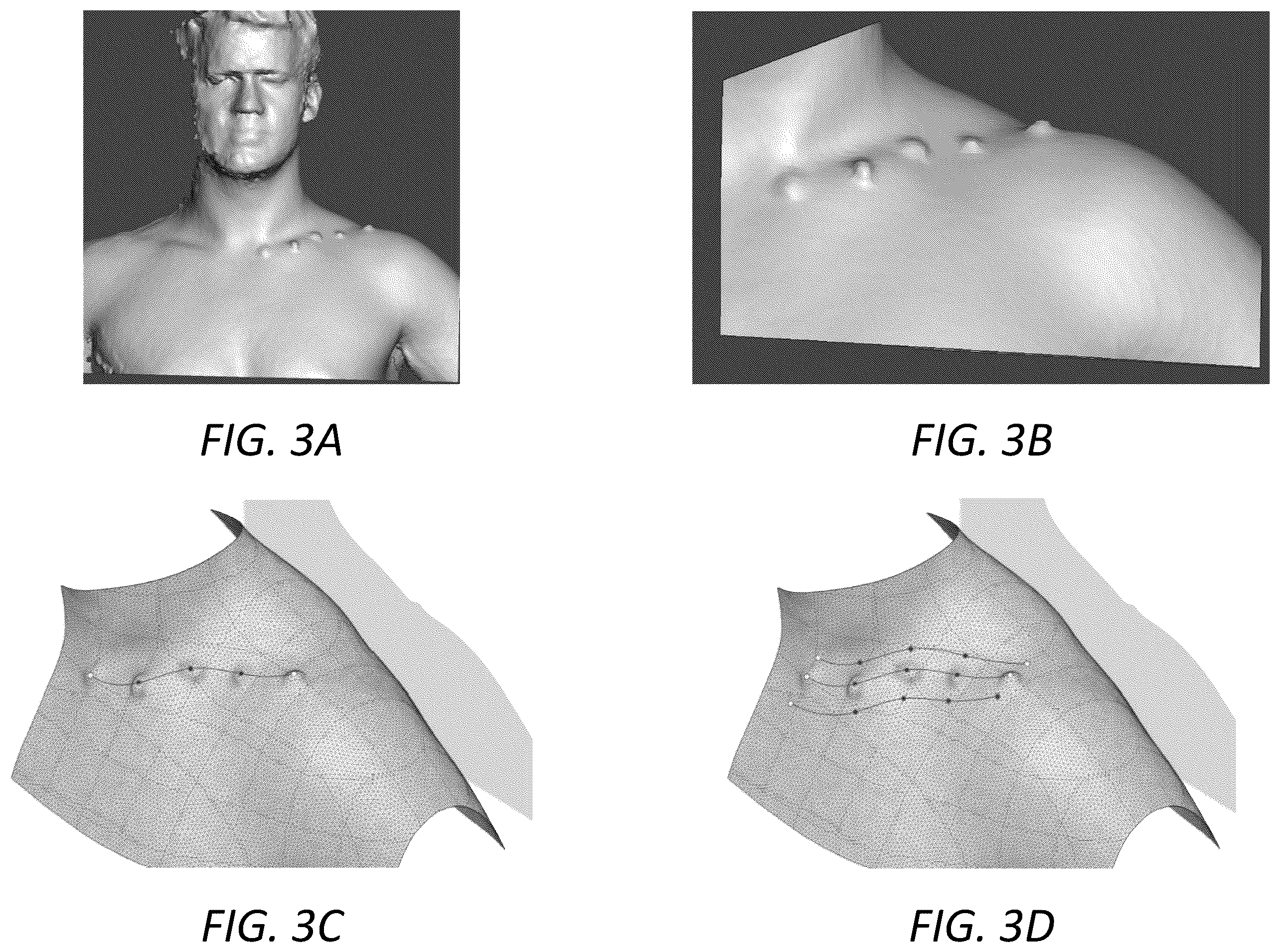 Patent US12396498 Figure 4 – Customized protective devices and systems and methods for producing the same