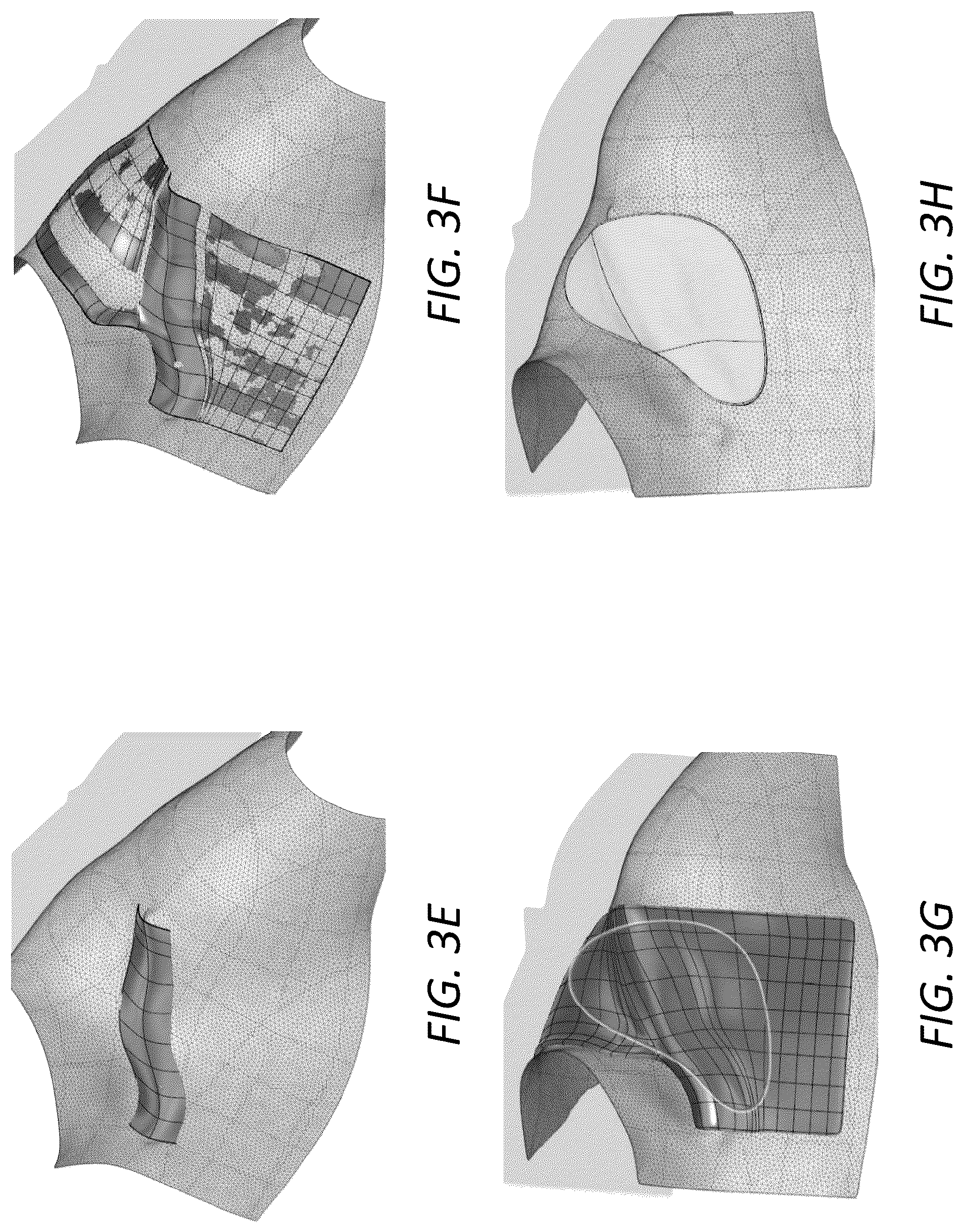 Patent US12396498 Figure 5 – Customized protective devices and systems and methods for producing the same