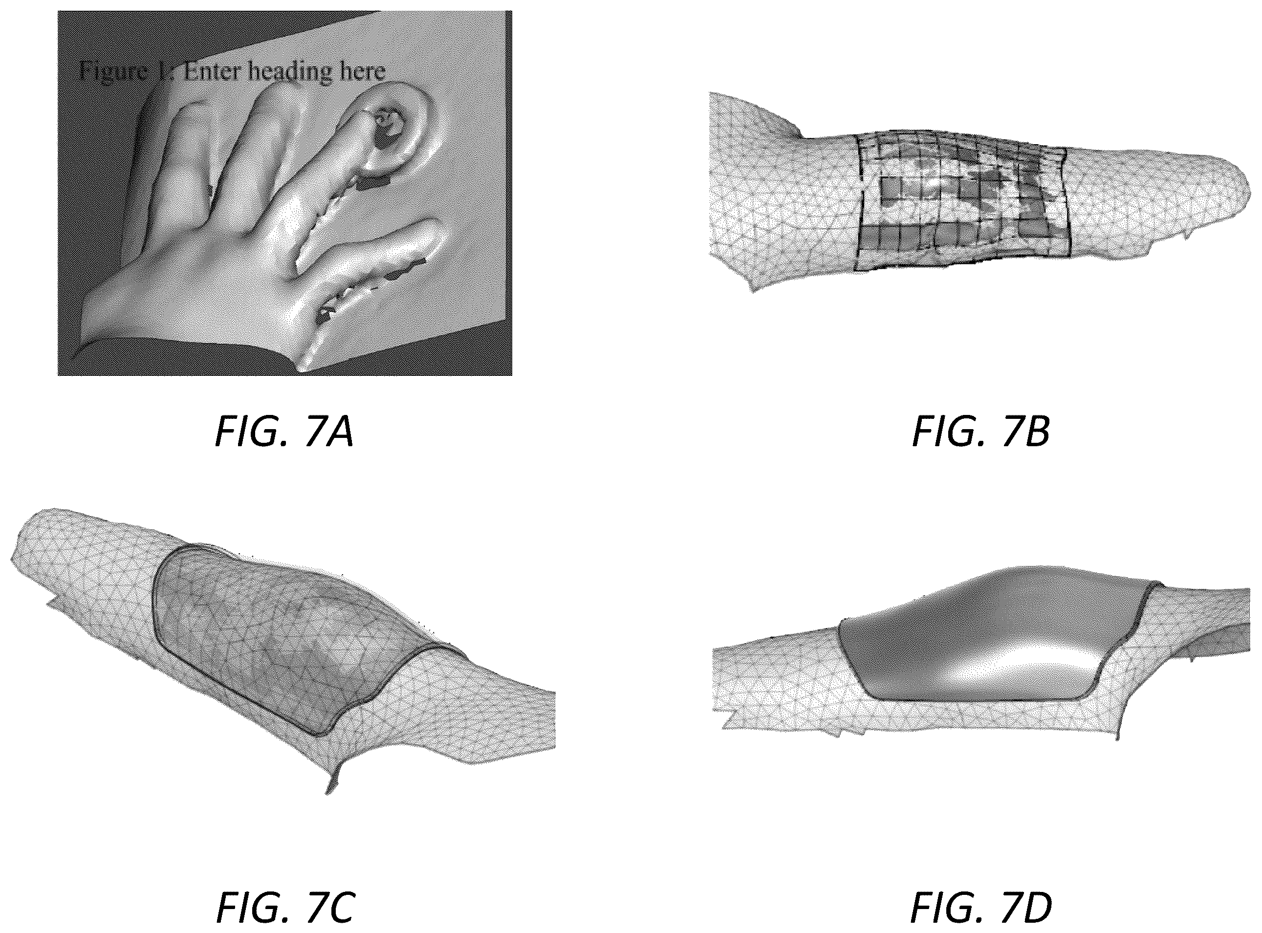 Patent US12396498 Figure 9 – Customized protective devices and systems and methods for producing the same