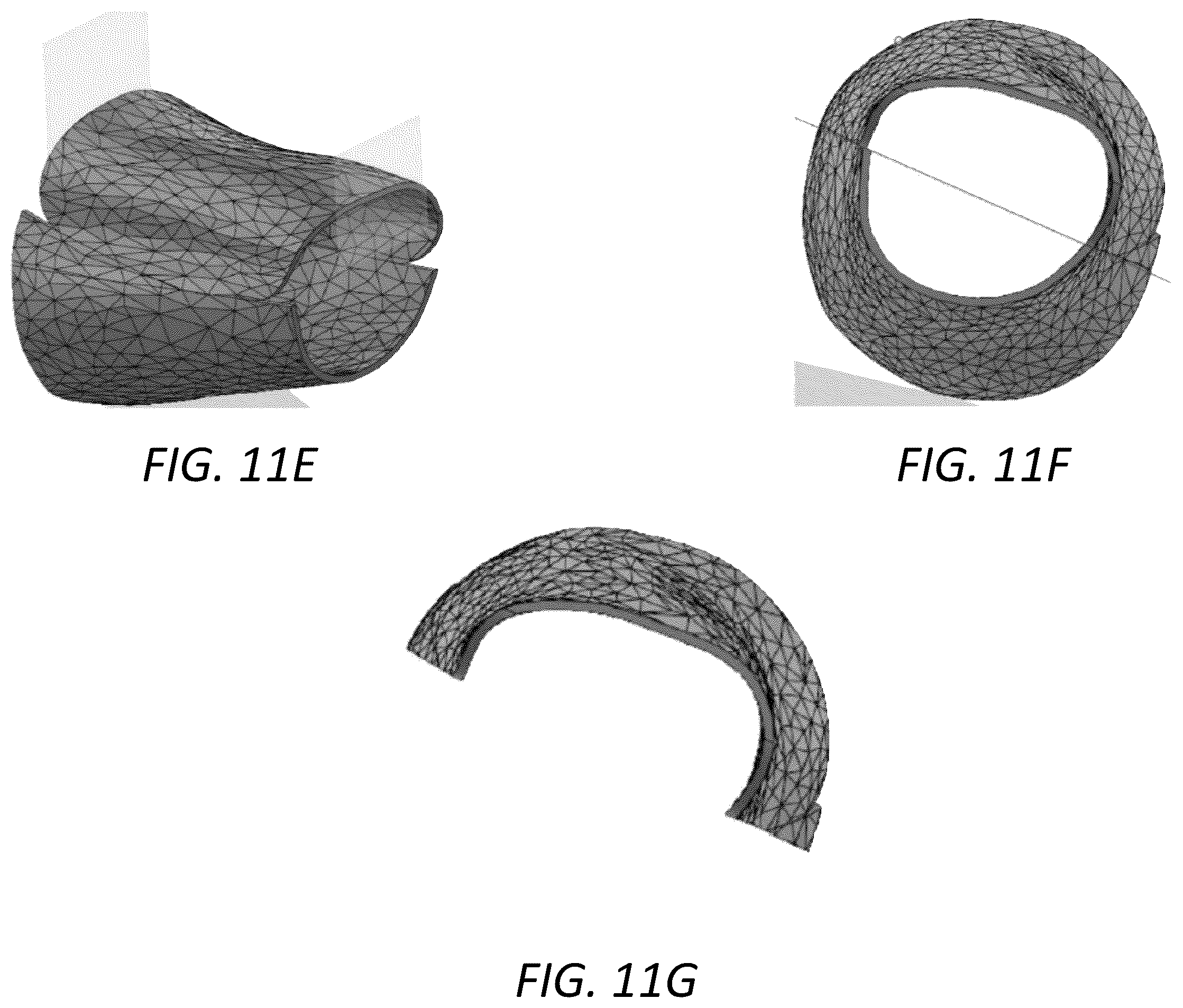Patent US12396498 Figure 17 – Customized protective devices and systems and methods for producing the same