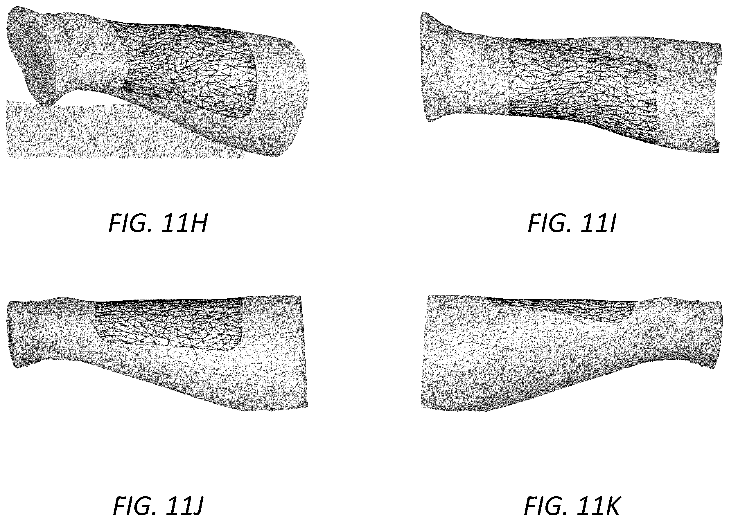 Patent US12396498 Figure 18 – Customized protective devices and systems and methods for producing the same