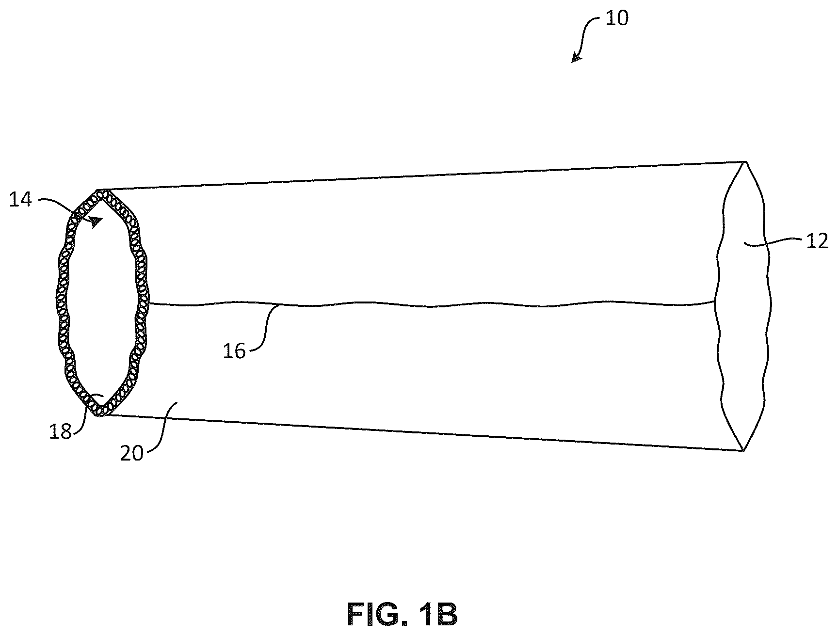 Patent US12396500 Figure 2 – Fluid management system, apparatus for making fluid management system and method of manufacturing fluid management system