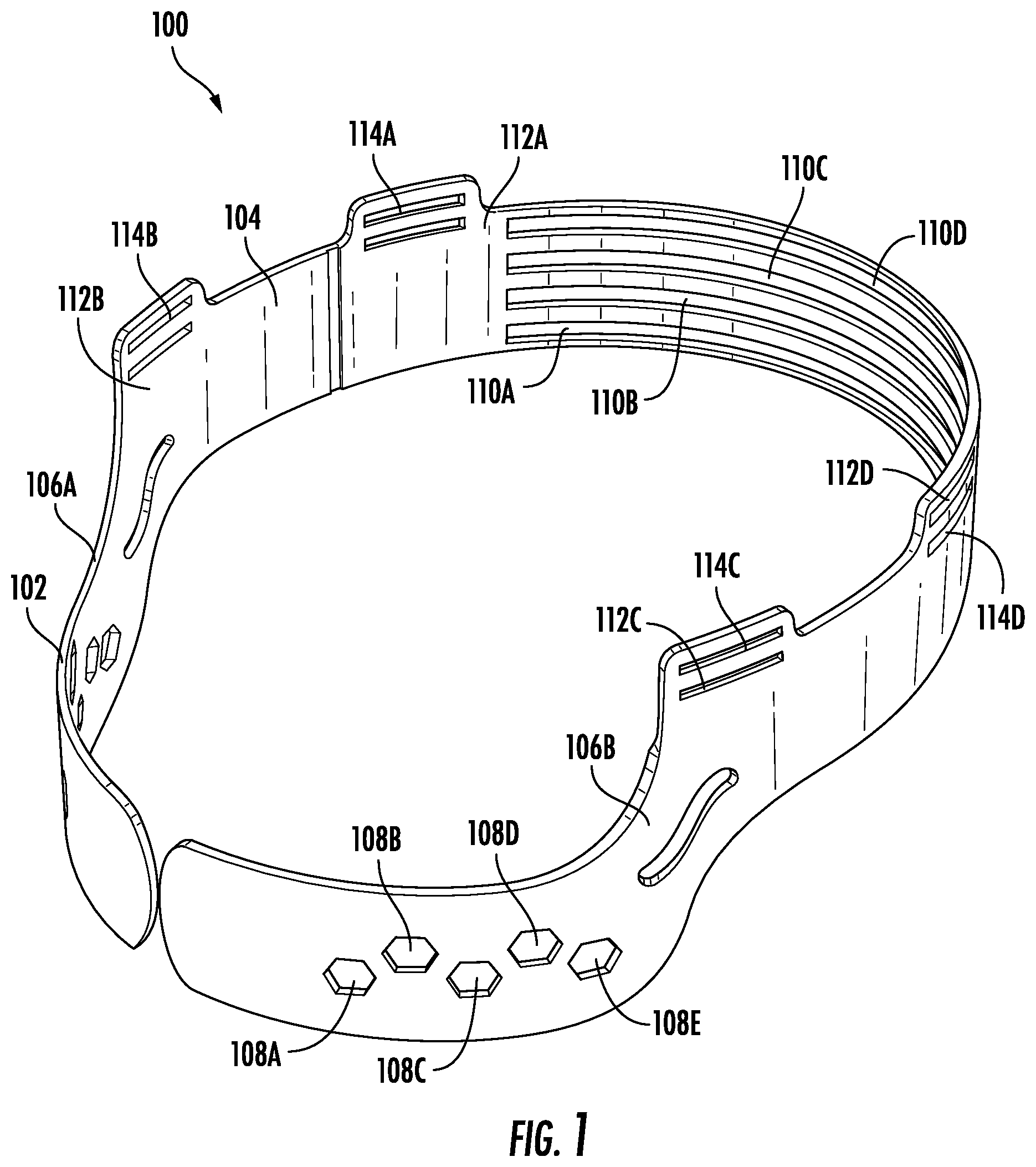 Patent US12396508 Figure 1 – Suspension assembly and method of manufacture
