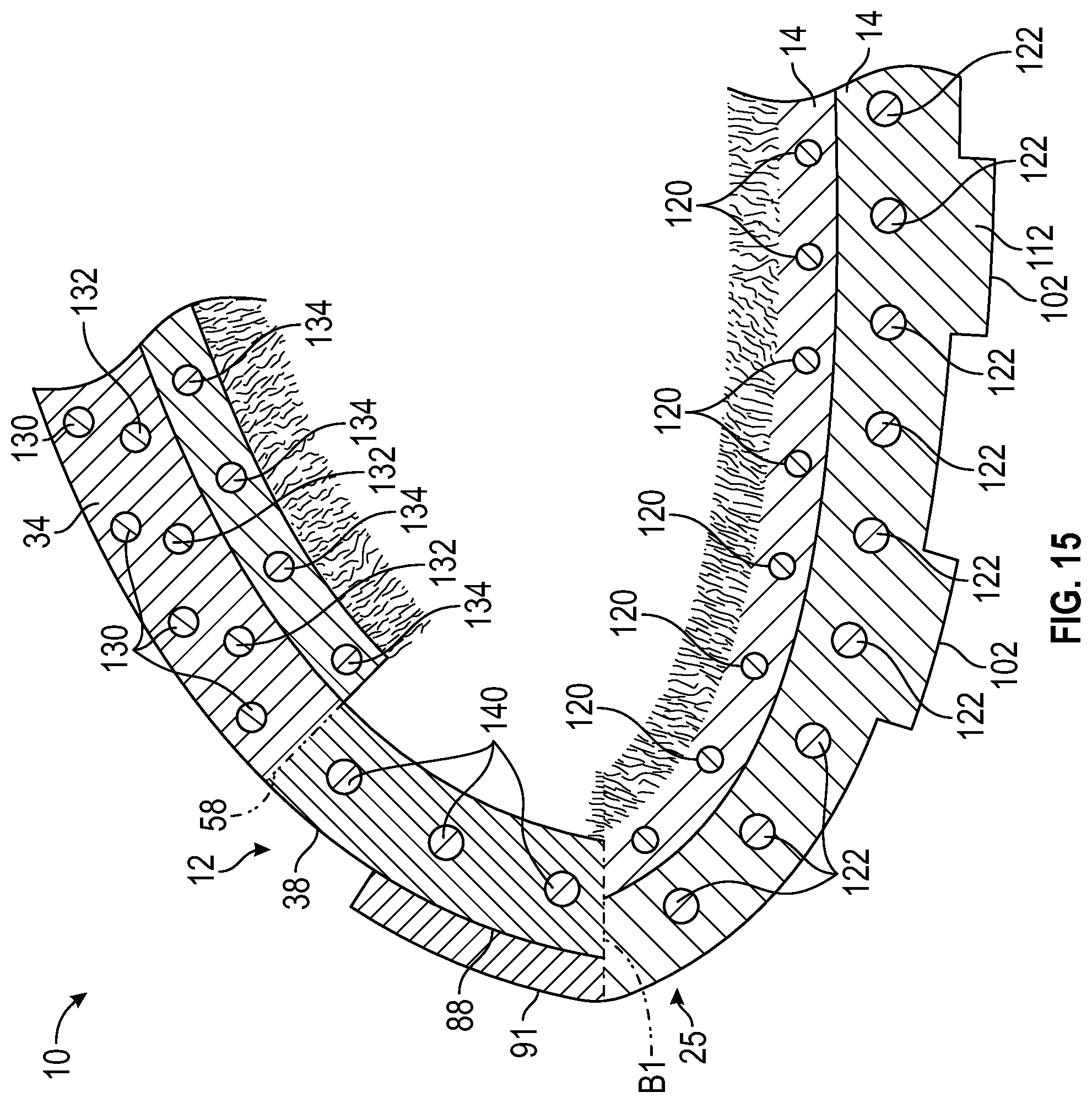 Patent US12396513 Figure 11 – Article of footwear with integrally-knitted upper and sole including grip yarn and method of manufacturing