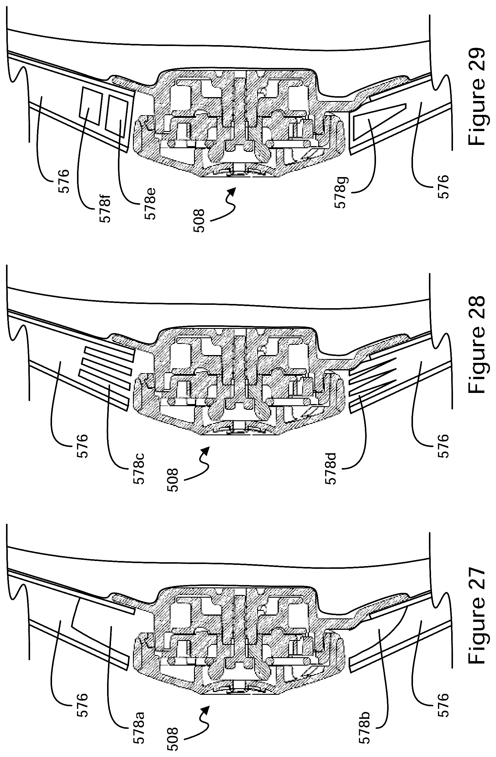 Patent US12396521 Figure 15 – Tightening mechanisms and applications including the same