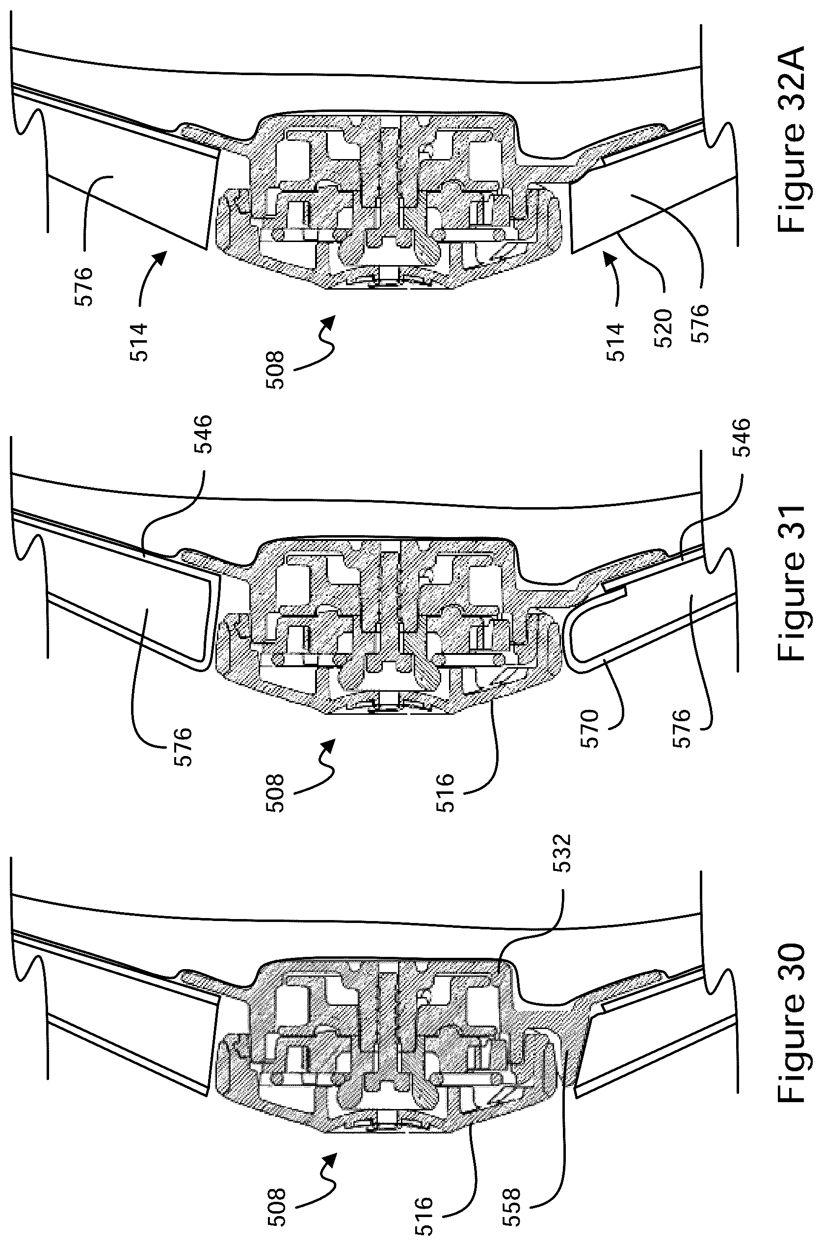 Patent US12396521 Figure 16 – Tightening mechanisms and applications including the same