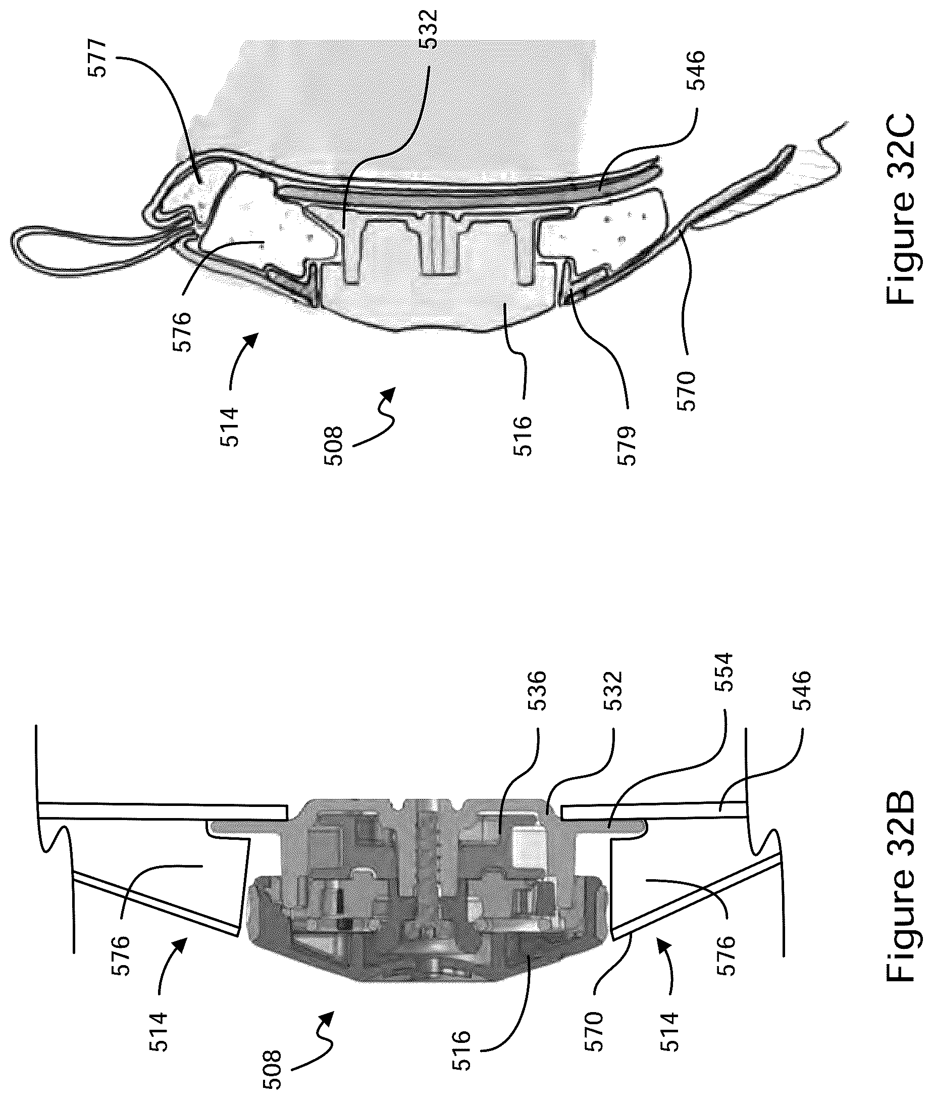 Patent US12396521 Figure 17 – Tightening mechanisms and applications including the same