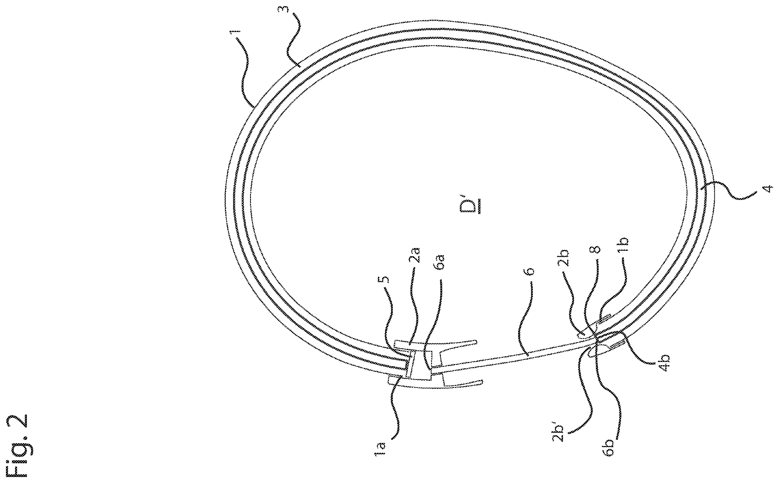 Patent US12396527 Figure 2 – Jewelry piece